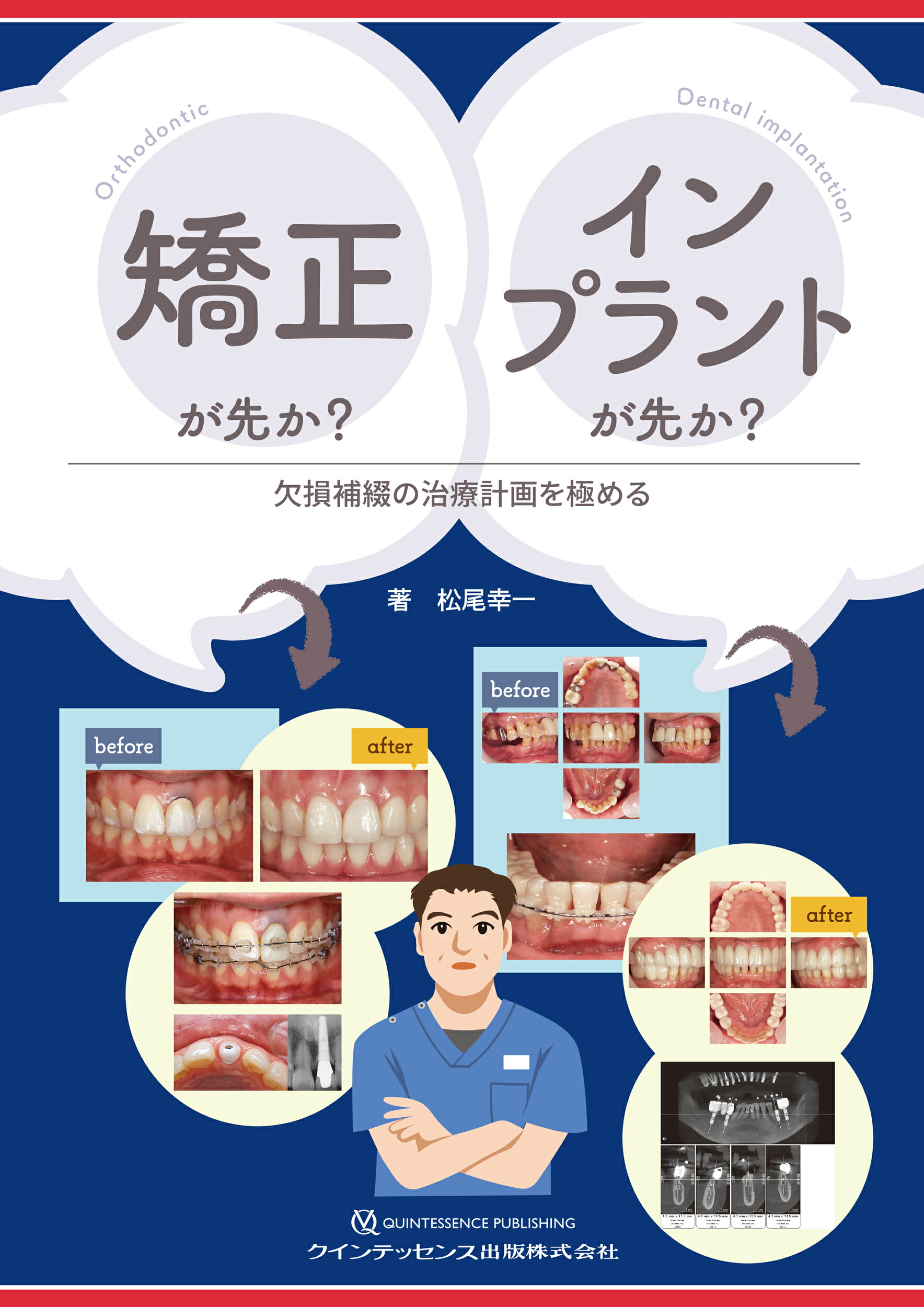 THE ALIGNER ORTHO アライナー矯正治療の最適解 THE ALIGNER ORTHO アライナー矯正治療の最適解: ALIGNER RADIO
