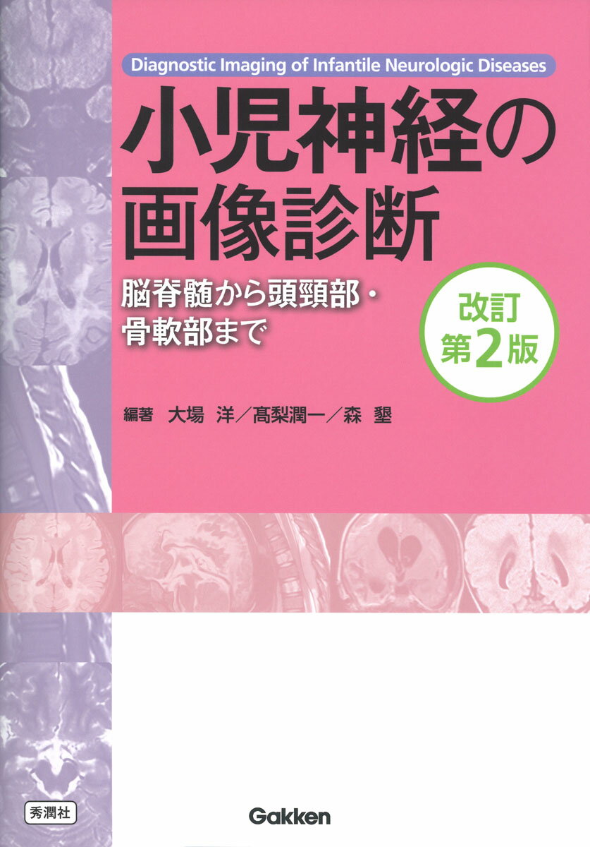 アトラス頭蓋骨顔面形成術 改訂新版 アトラス頭蓋骨顔面形成術 改訂新版 |本 | 通販 | Amazon
