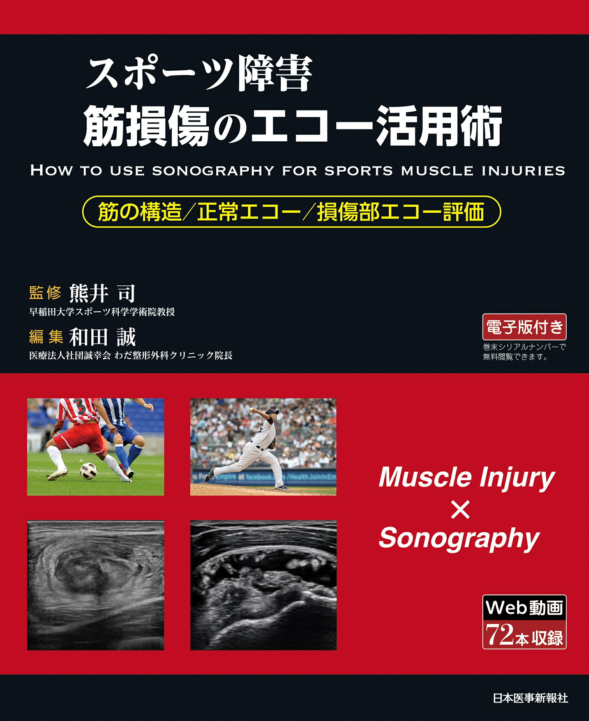 スポーツ障害　筋損傷のエコー活用術/日本医事新報社/和田誠