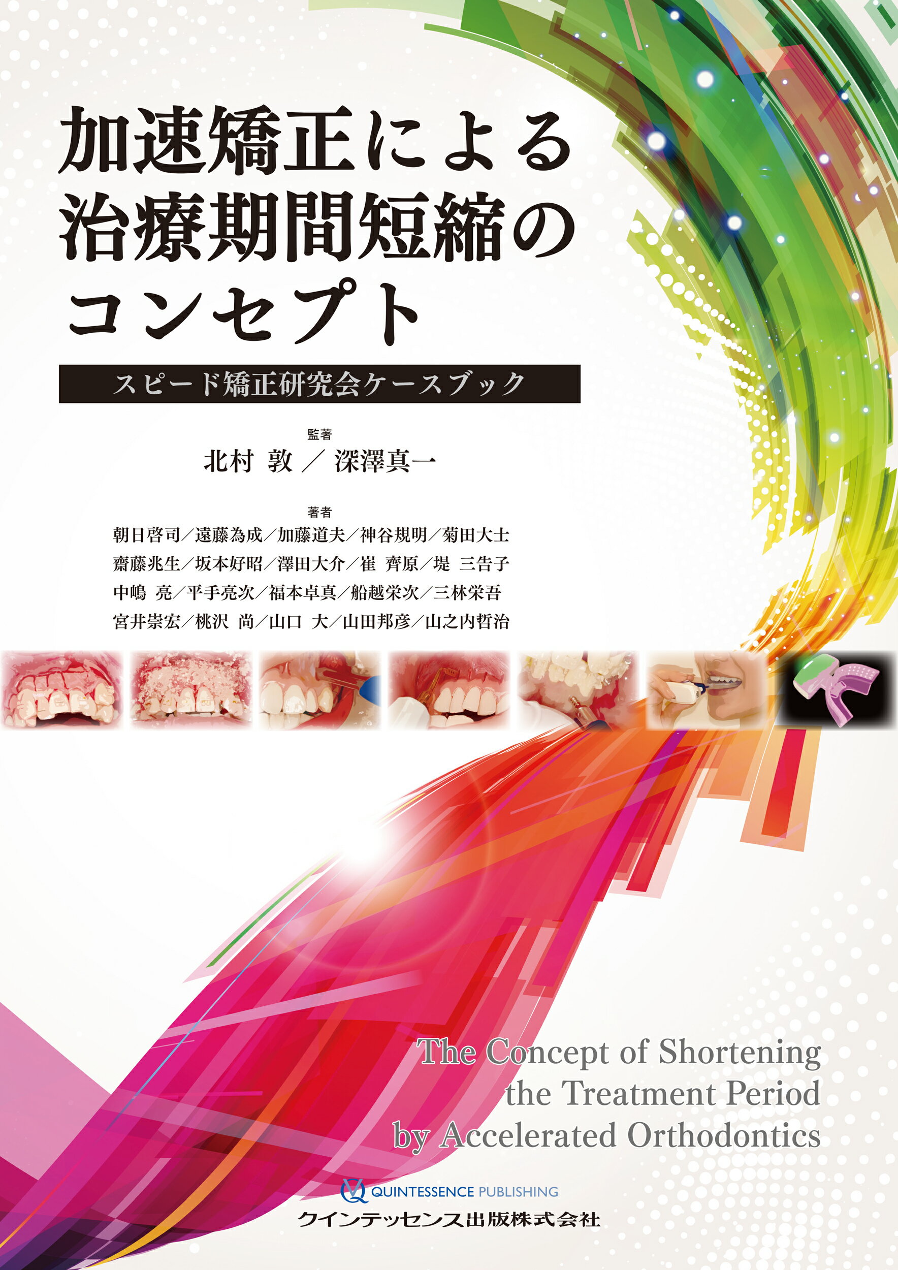 THE ALIGNER ORTHO アライナー矯正治療の最適解 THE ALIGNER ORTHO アライナー矯正治療の最適解: ALIGNER RADIO