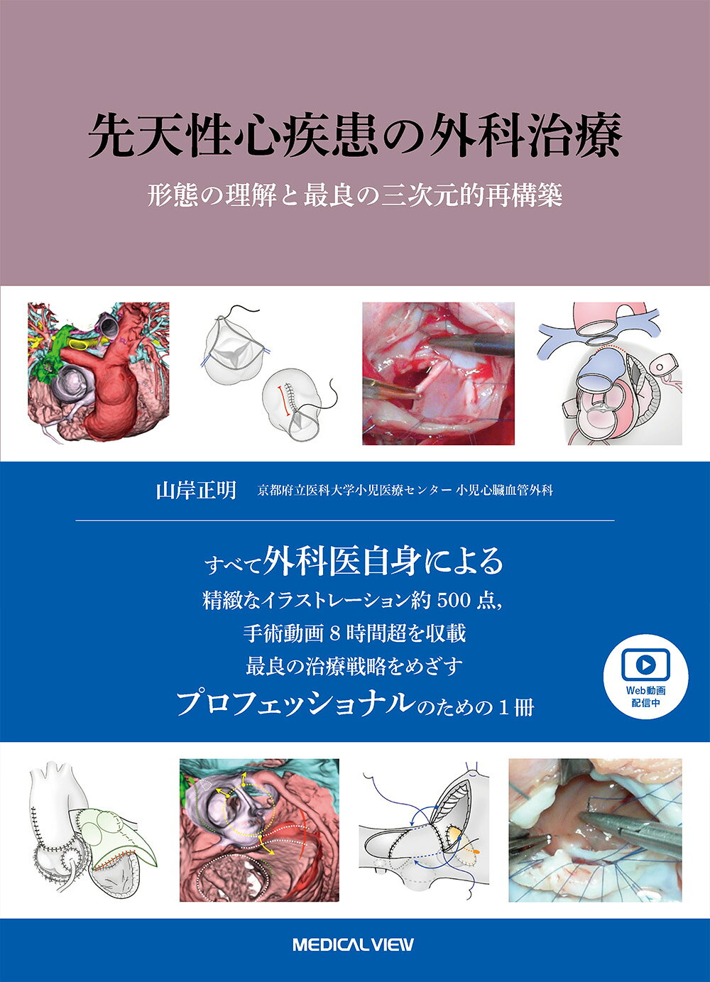 楽天市場】メジカルビュー社 新先天性心疾患を理解するための臨床心臓