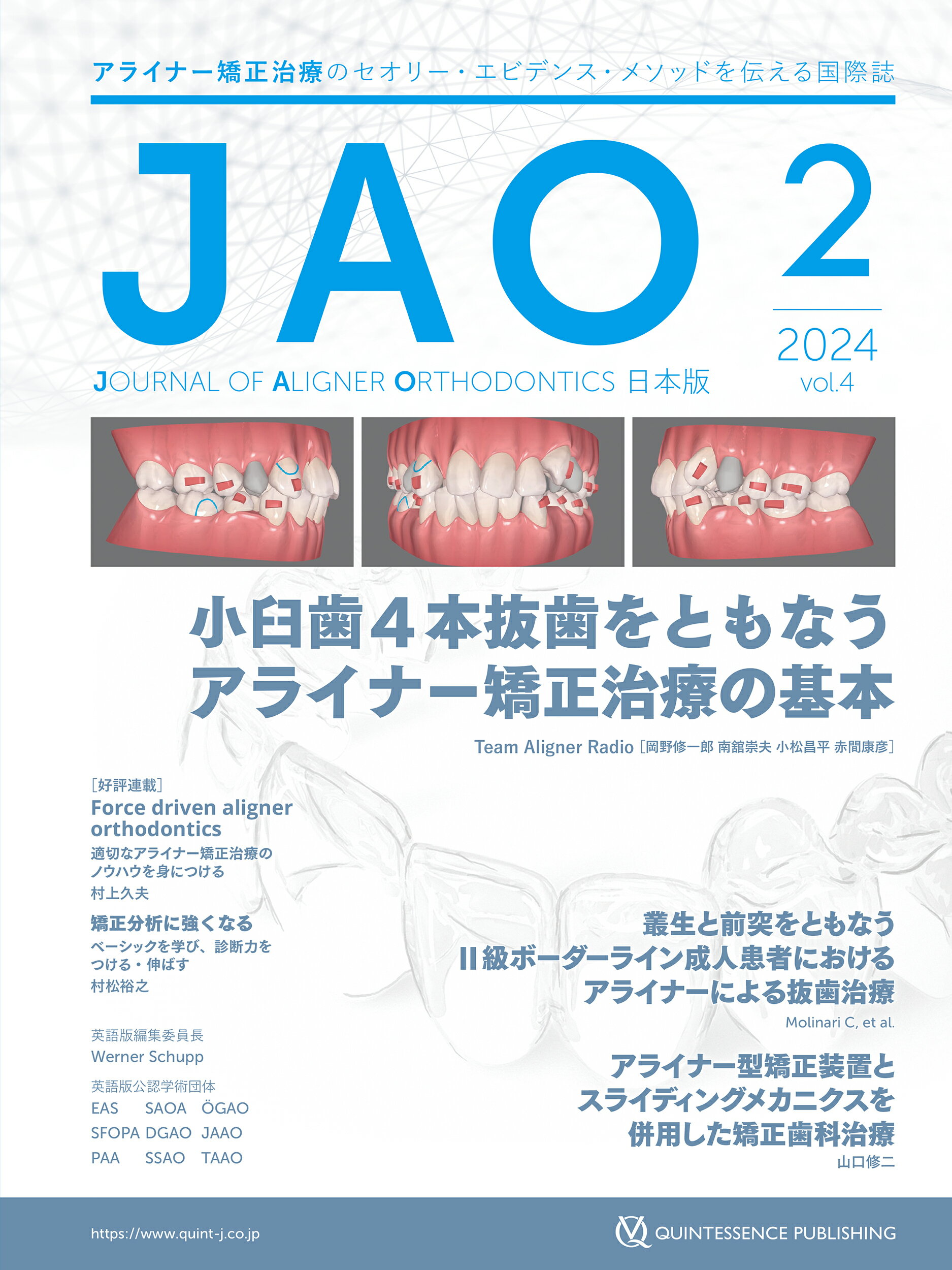 ＪＯＵＲＮＡＬ　ＯＦ　ＡＬＩＧＮＥＲ　ＯＲＴＨＯＤＯＮＴＩＣＳ日本版 ２０２４年　Ｖｏｌ．４　ｉｓｓ/クインテッセンス出版/クインテッセンス出版
