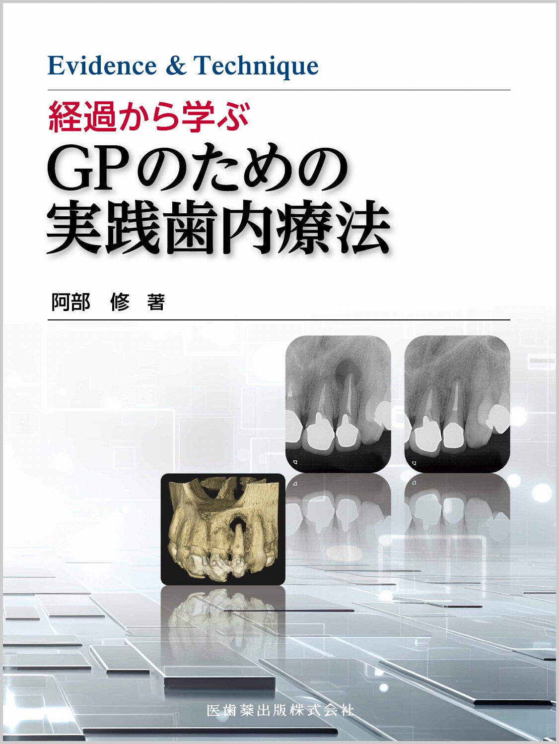 楽天市場】成功に導く考えかたと着眼点がわかる歯内療法のルール