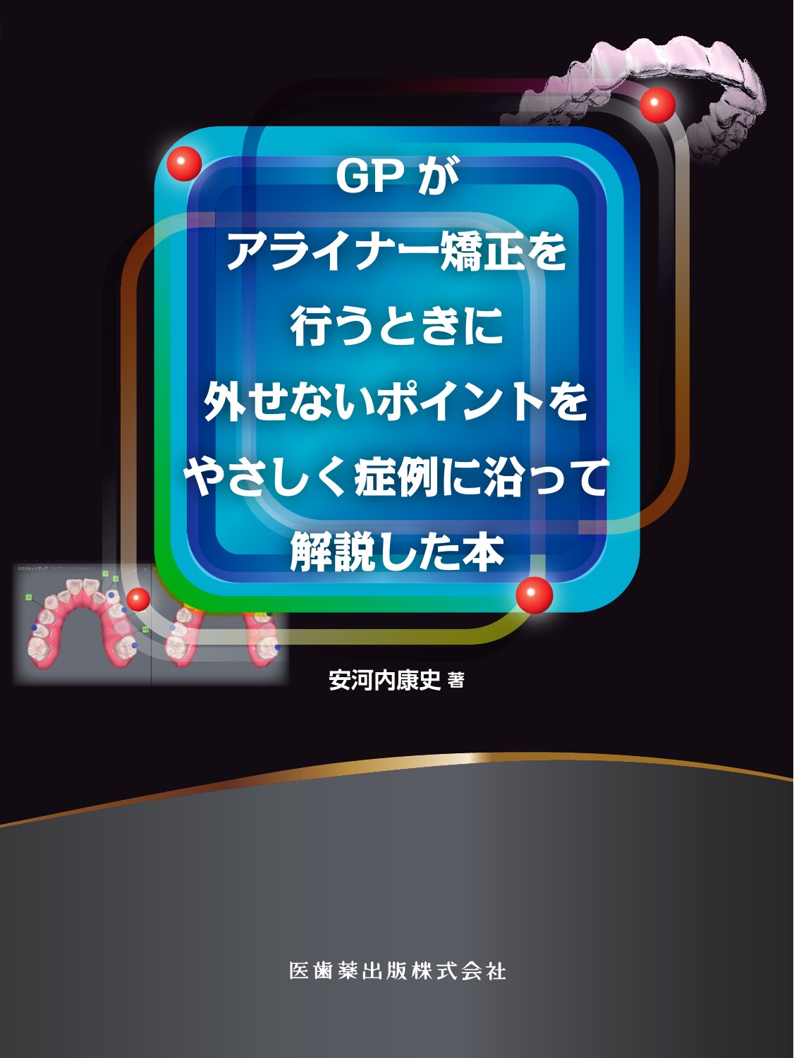 楽天市場】クインテッセンス出版 THE ALIGNER
