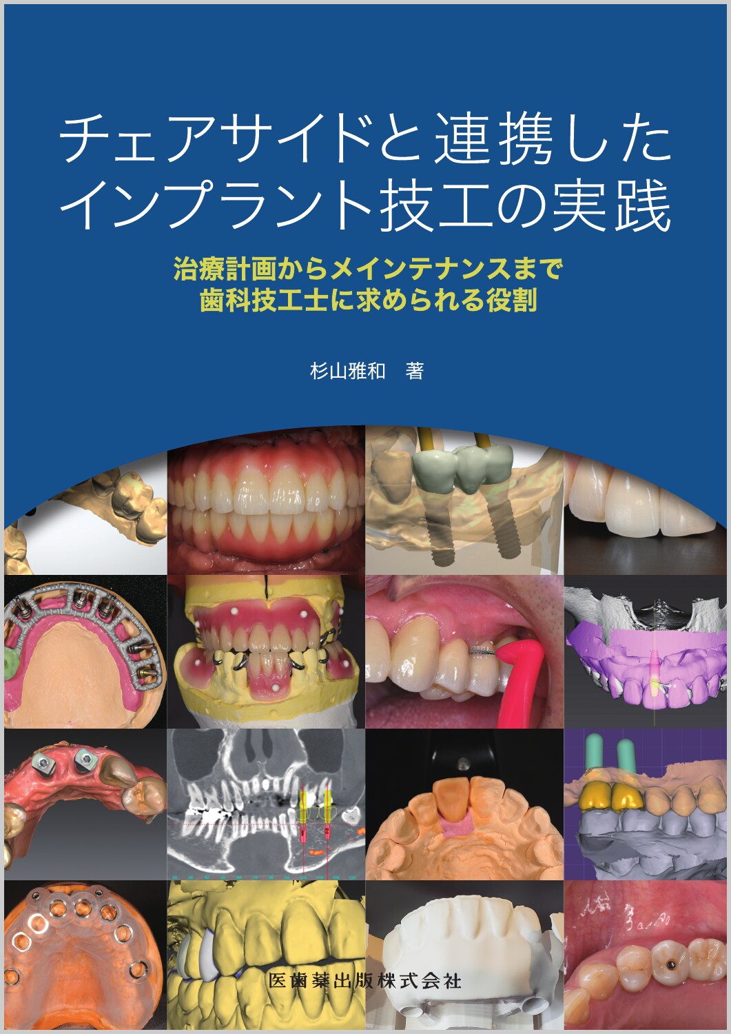 【裁断済み】ホームケア指導 パーフェクトマニュアル 予防歯科を充実させたい歯科医院のためのホームケア指導パーフェ