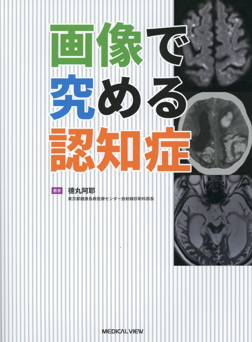画像で究める認知症/メジカルビュ-社/□丸阿耶