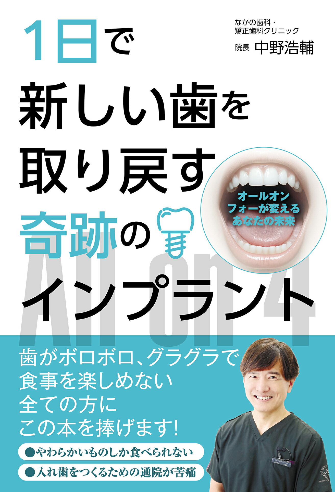１日で新しい歯を取り戻す奇跡のインプラント　オールオンフォーが変えるあなたの未来/なかの歯科クリニック/中野浩輔