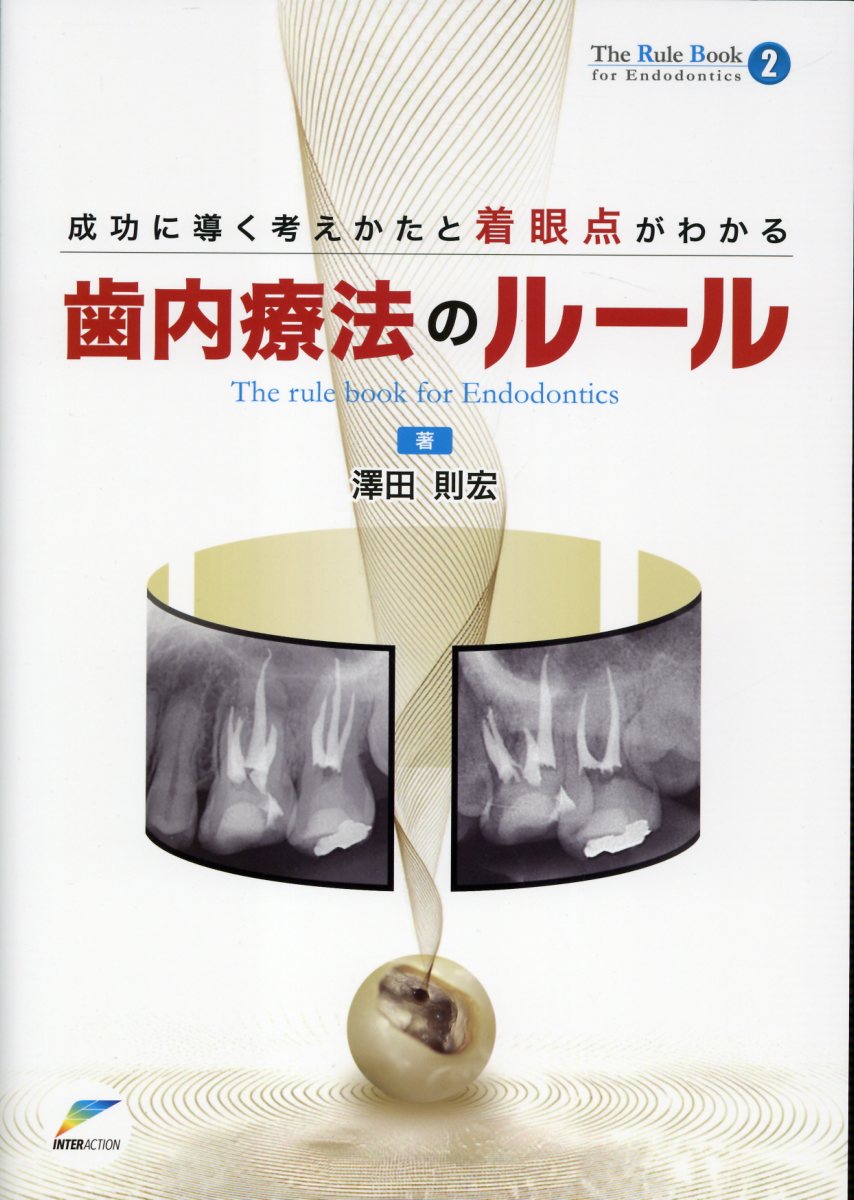 楽天市場】クインテッセンス出版 悩めるエンド難症例 診断のポイントと