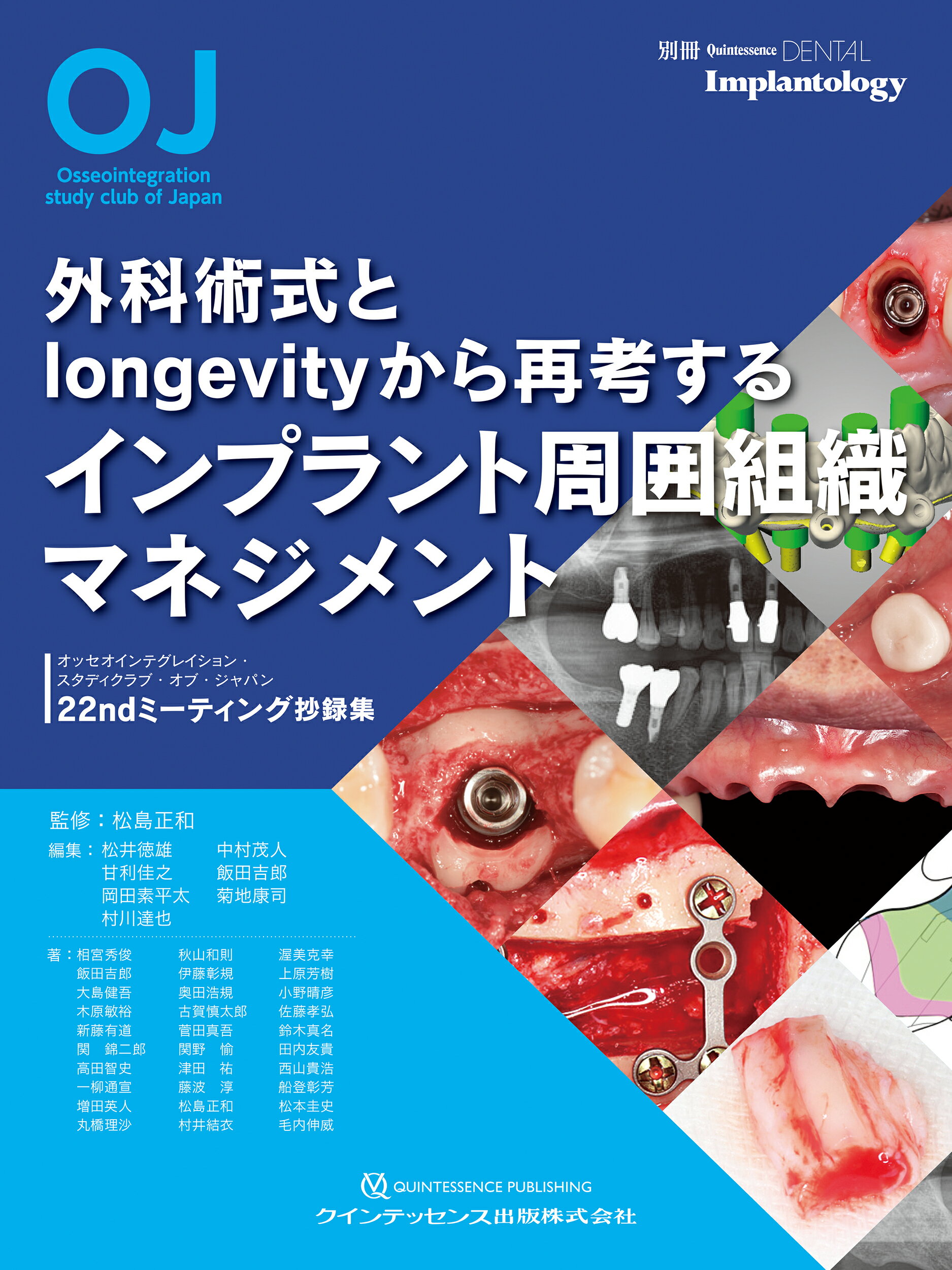 外科術式とｌｏｎｇｅｖｉｔｙから再考するインプラント周囲組織マネジメント/クインテッセンス出版/松島正和