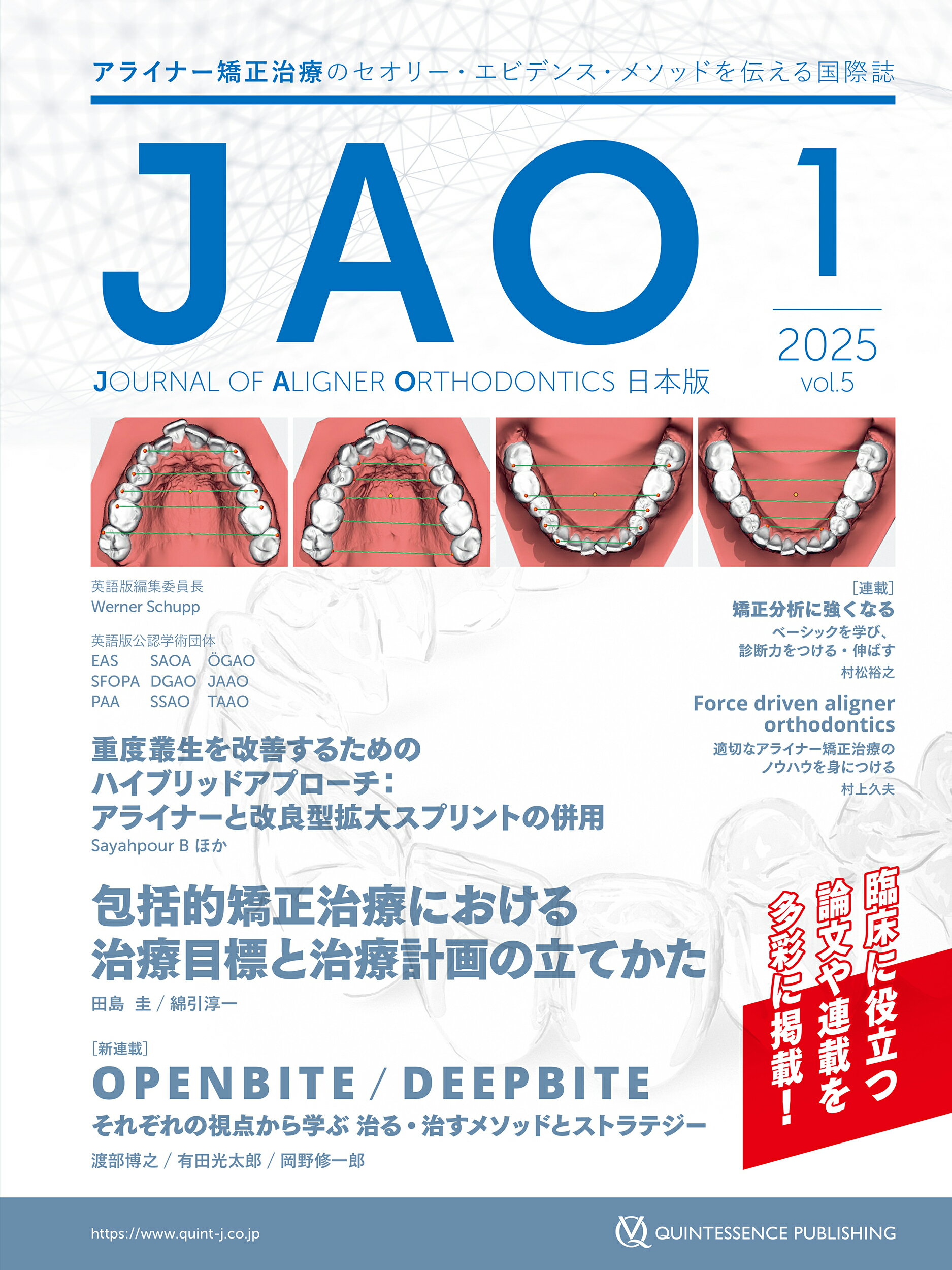ＪＯＵＲＮＡＬ　ＯＦ　ＡＬＩＧＮＥＲ　ＯＲＴＨＯＤＯＮＴＩＣＳ日本版 ２０２５年　Ｖｏｌ．５　ｉｓｓ/クインテッセンス出版/クインテッセンス出版