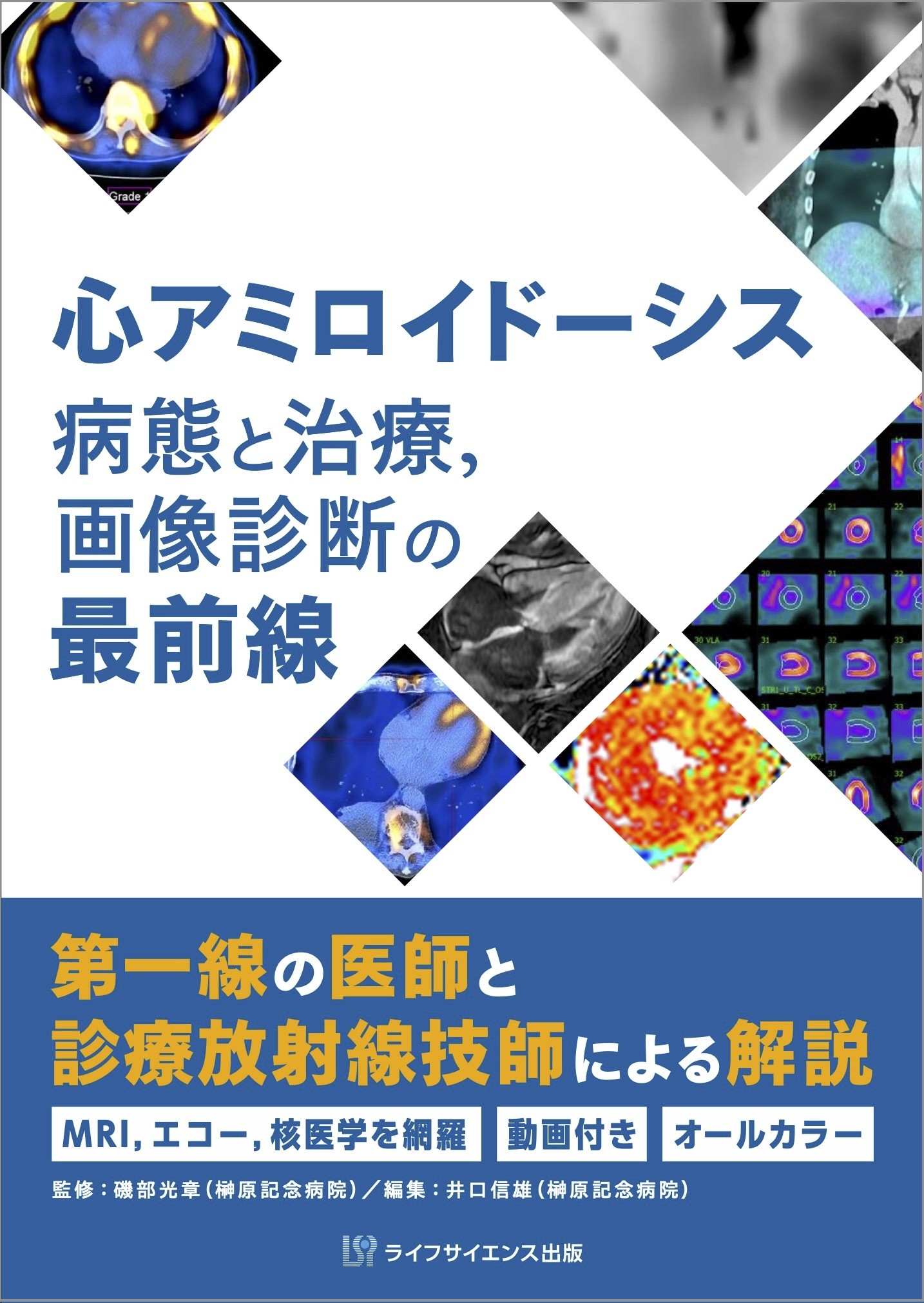 楽天市場】医歯薬出版 アミロイドーシス診療ガイドライン 2025/医