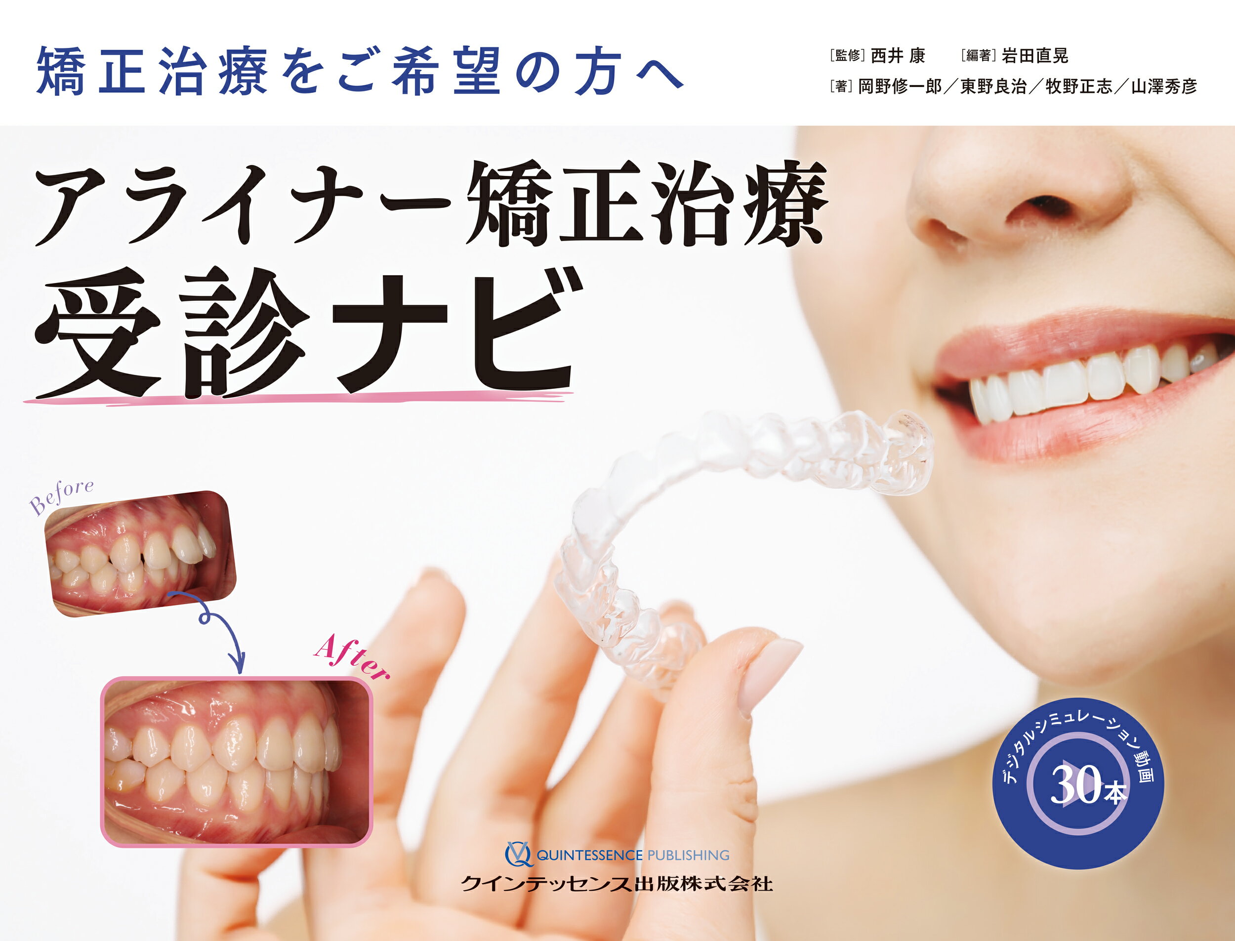 アライナー矯正治療受診ナビ 矯正治療をご希望の方へ/クインテッセンス出版/西井康