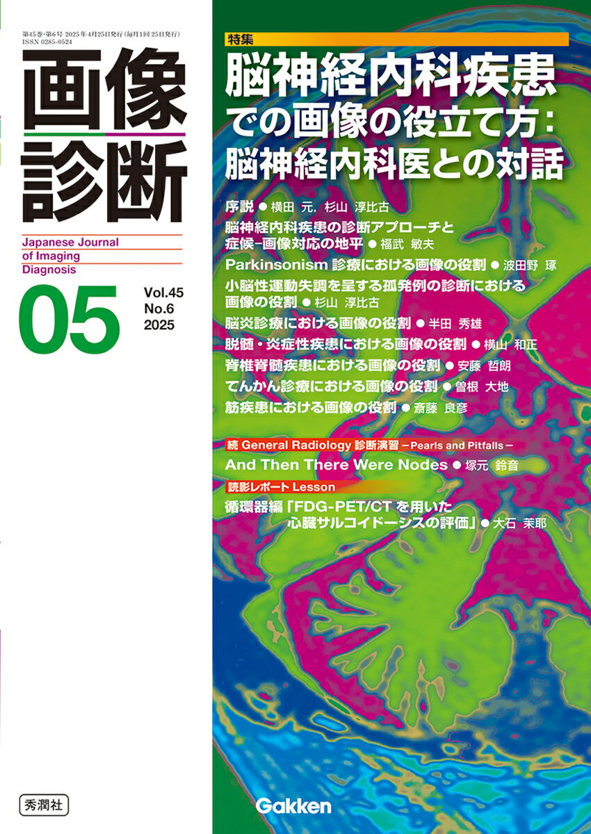 画像診断 ２０２５年５月号Ｖｏｌ．４５Ｎ/Ｇａｋｋｅｎ