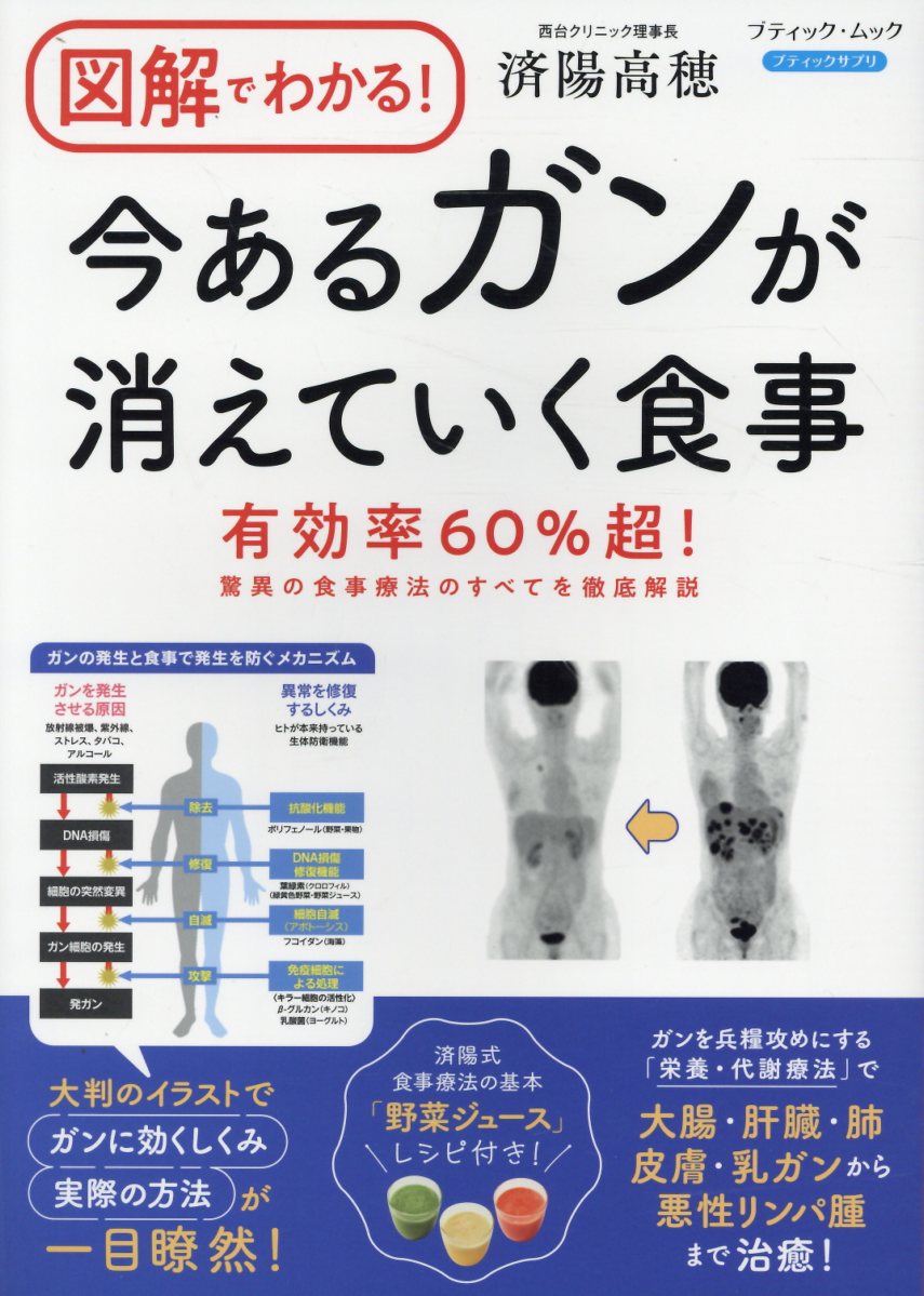 楽天市場】マキノ出版 今あるガンが消えていく食事 進行ガンでも有効率