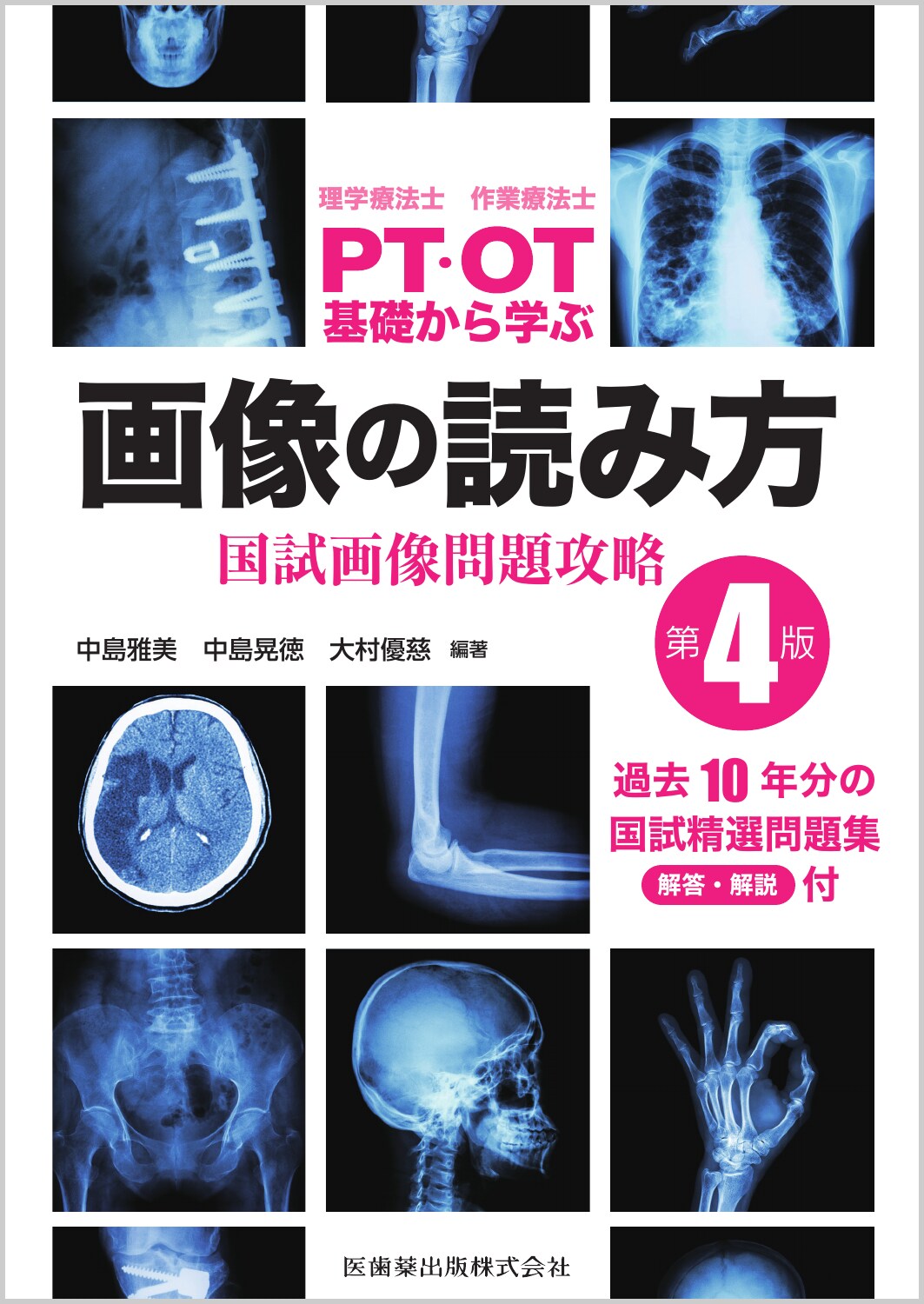 理学療法士・作業療法士ＰＴ・ＯＴ基礎から学ぶ画像の読み方国試画像問題攻略 第４版/医歯薬出版/中島雅美