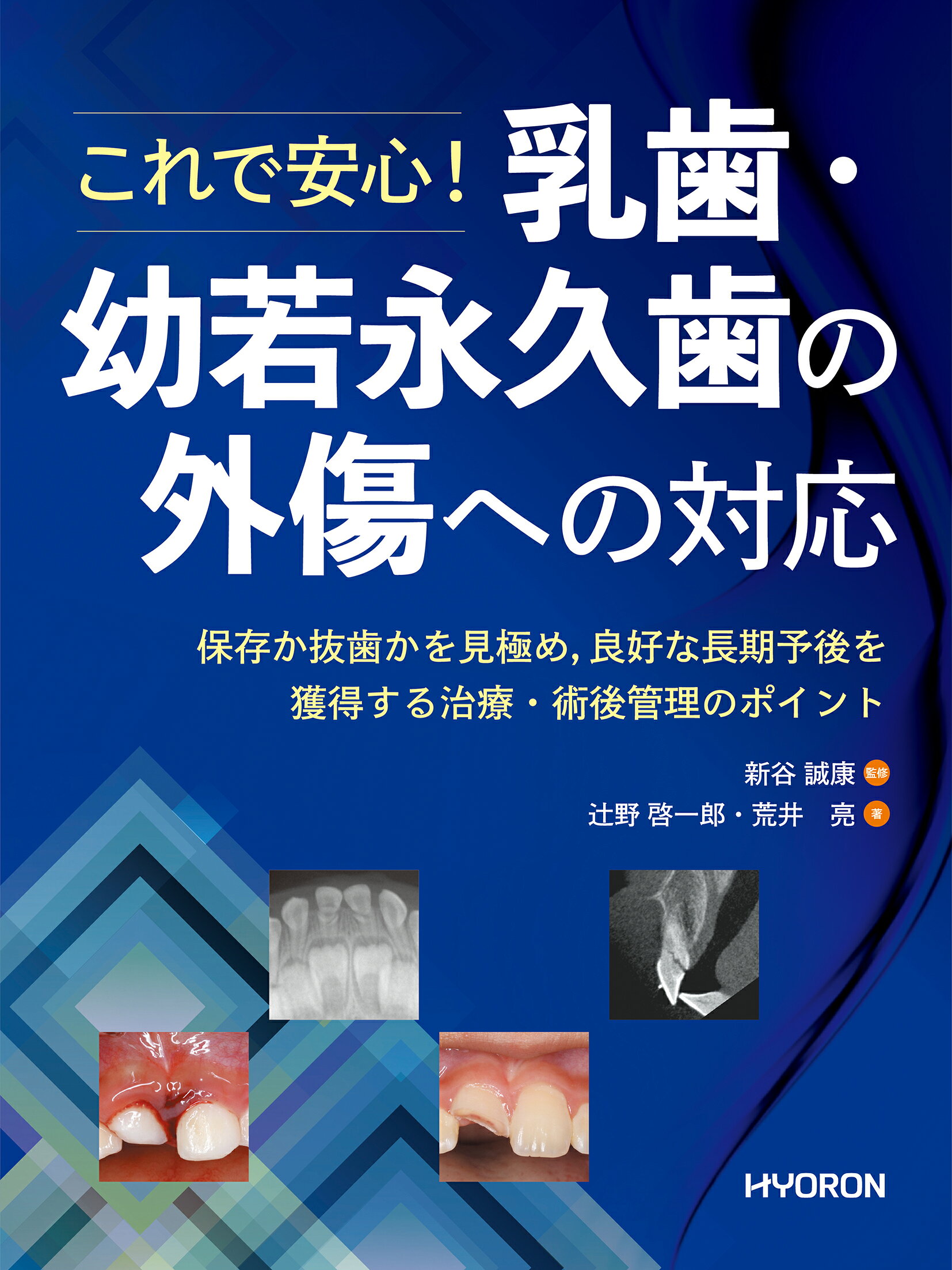 楽天市場】クインテッセンス出版 顎矯正手術エッセンシャル ビジュアル