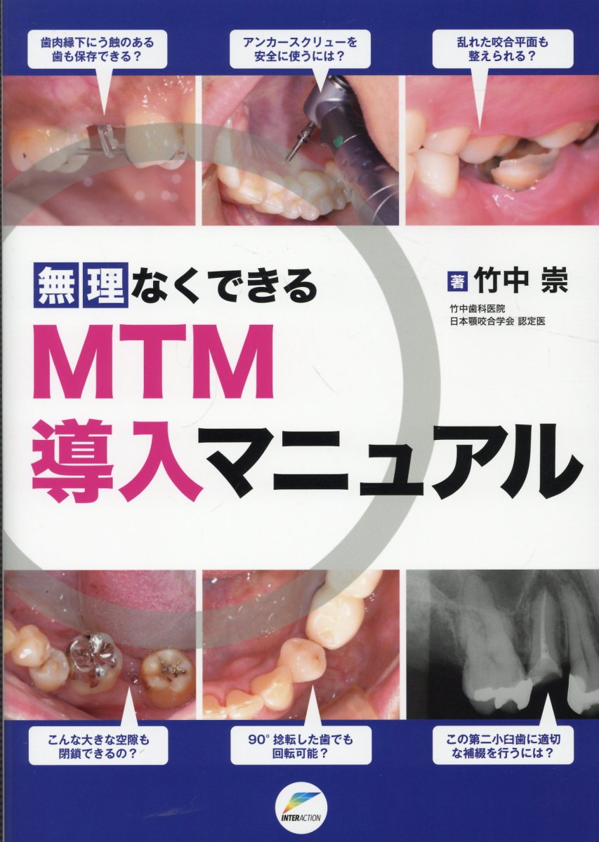 楽天市場】無理なくできるサイナスリフト導入マニュアル/インタ