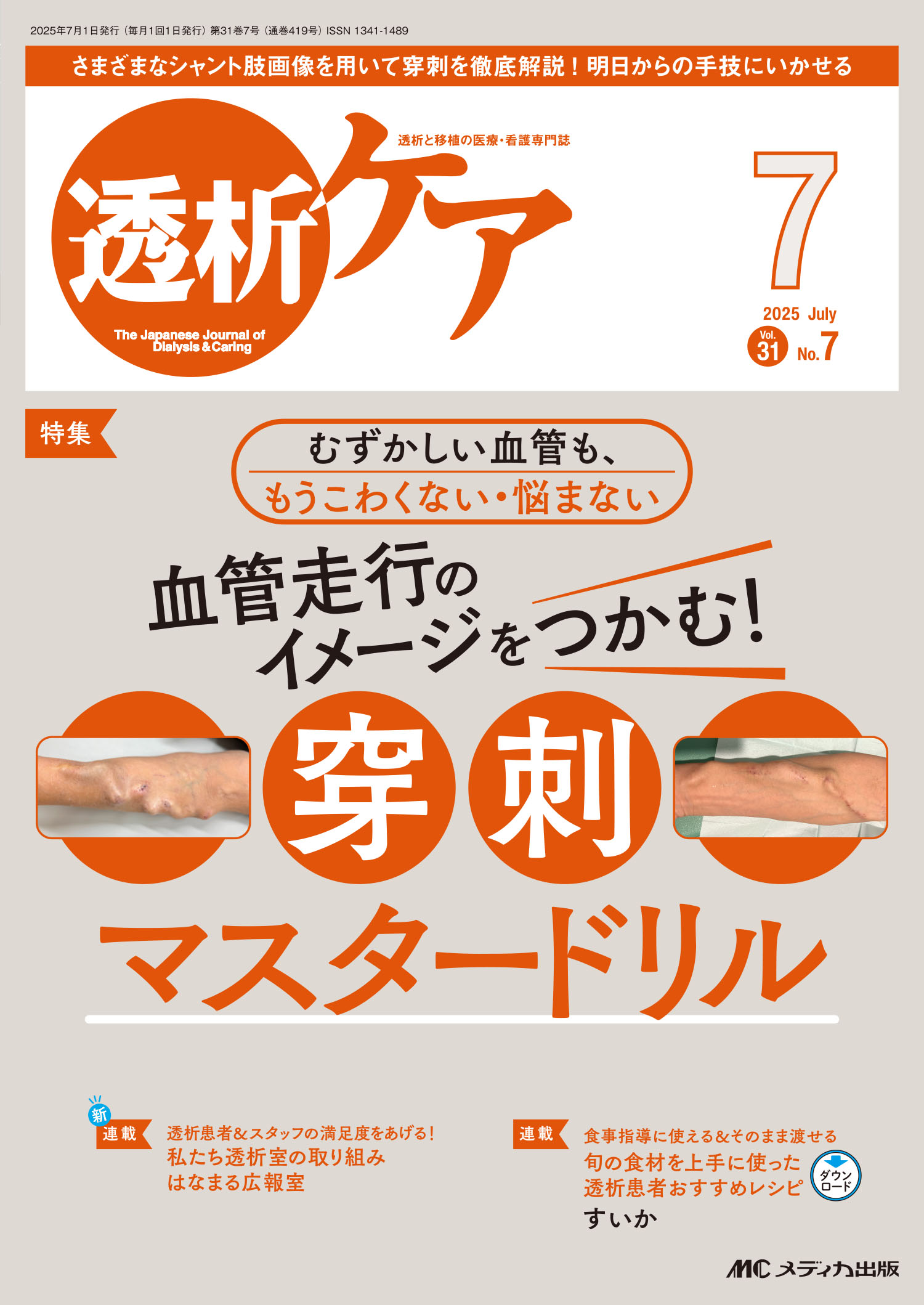 透析ケア 透析と移植の医療・看護専門誌 ２０２５　７（Ｖｏｌ．３１　Ｎ/メディカ出版