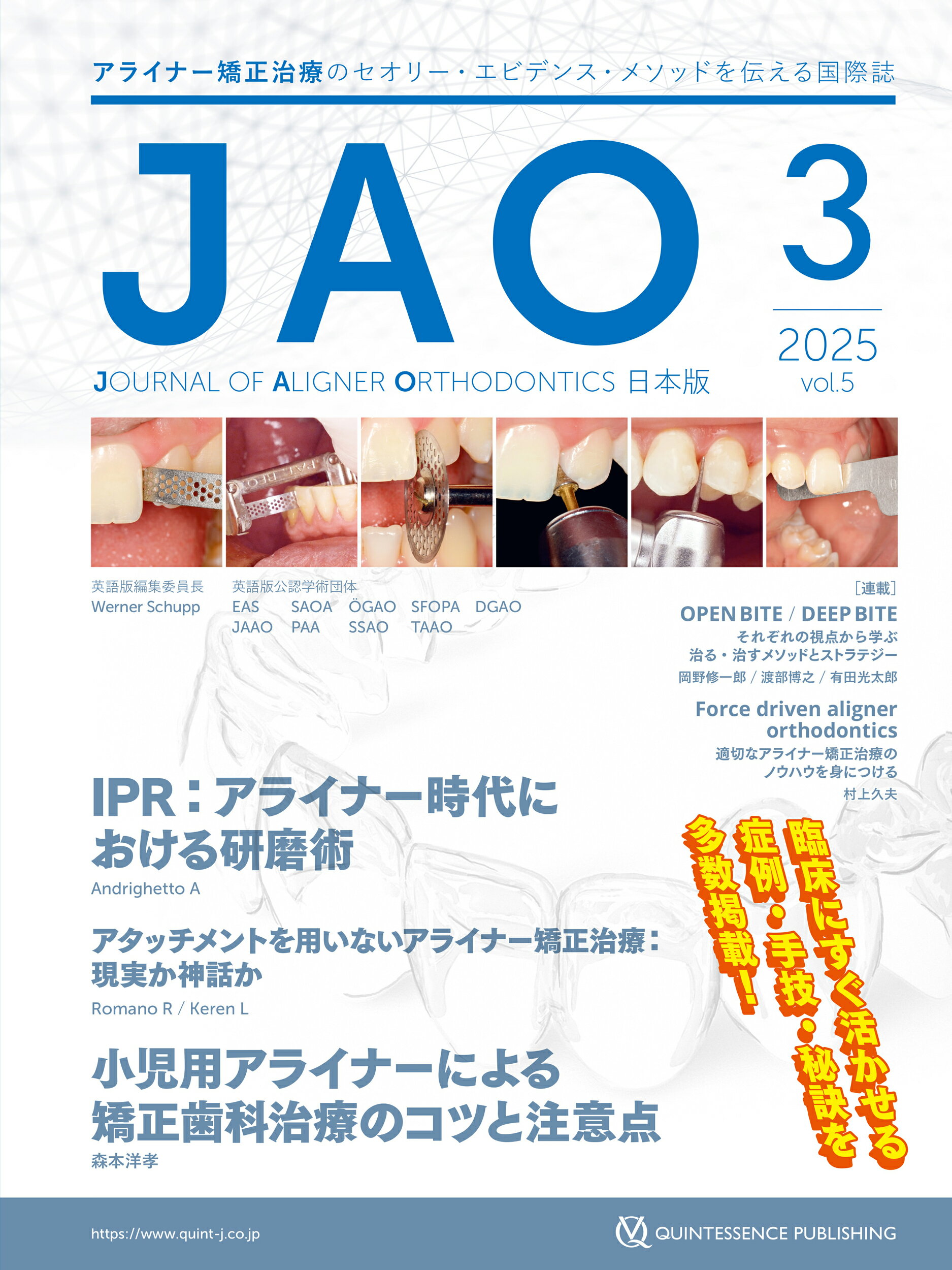 ＪＯＵＲＮＡＬ　ＯＦ　ＡＬＩＧＮＥＲ　ＯＲＴＨＯＤＯＮＴＩＣＳ日本版 ２０２５年　Ｖｏｌ．５　ｉｓｓ/クインテッセンス出版/クインテッセンス出版