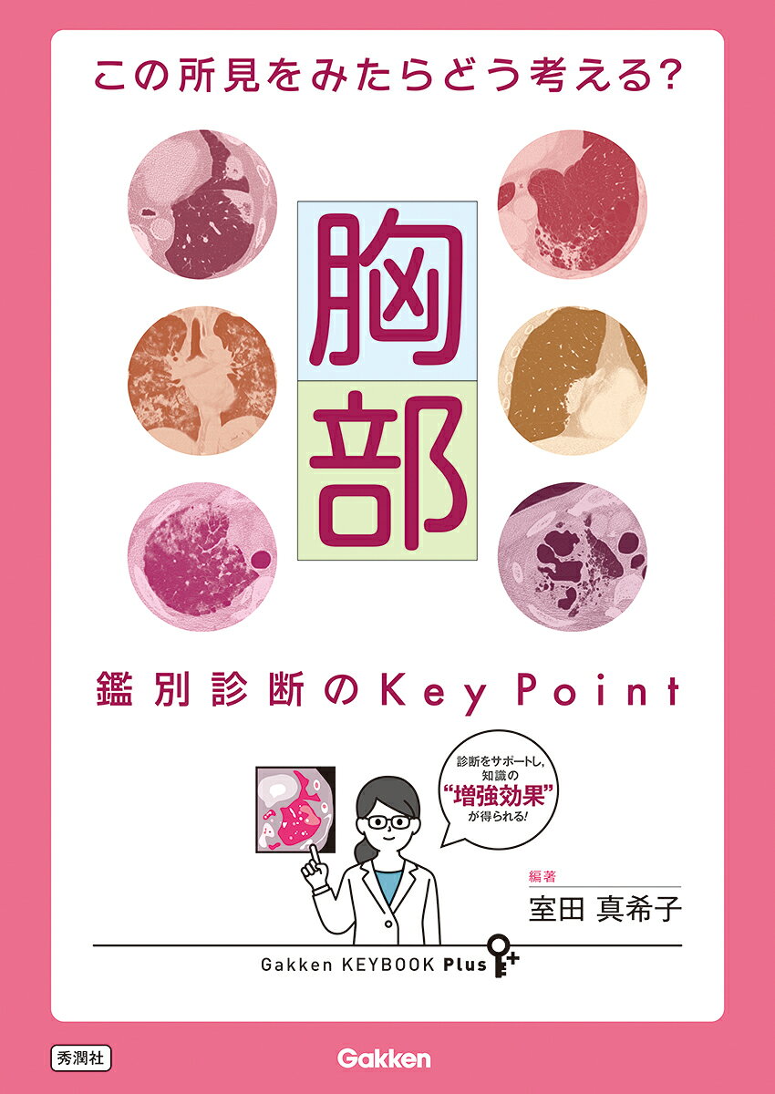 この所見をみたらどう考える？　胸部　鑑別診断のＫｅｙ　Ｐｏｉｎｔ/Ｇａｋｋｅｎ/室田真希子