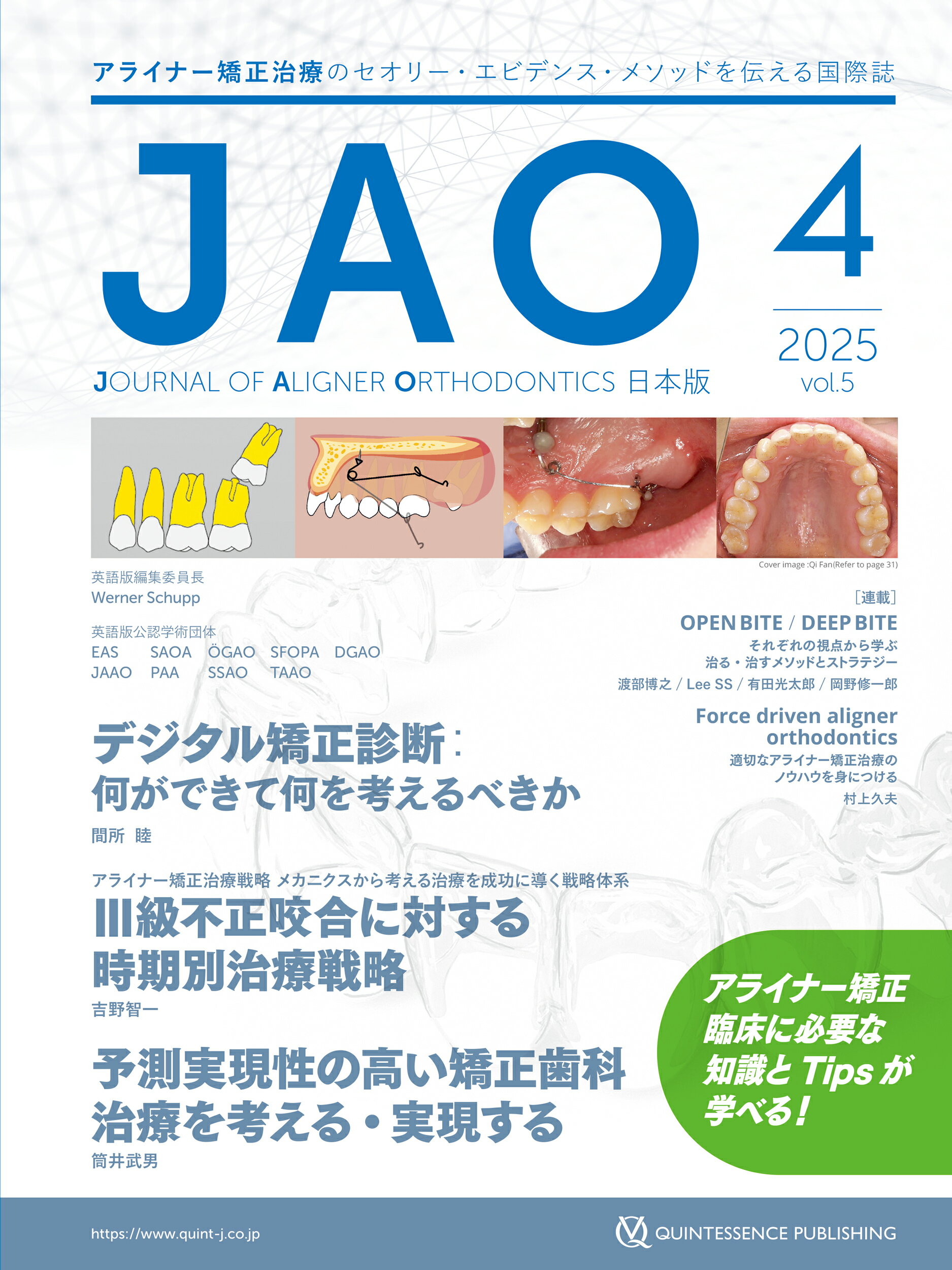 ＪＯＵＲＮＡＬ　ＯＦ　ＡＬＩＧＮＥＲ　ＯＲＴＨＯＤＯＮＴＩＣＳ日本版 アライナー矯正治療のセオリー・エビデンス・メソッド ２０２５年　Ｖｏｌ．５　ｉｓｓ/クインテッセンス出版/クインテッセンス出版