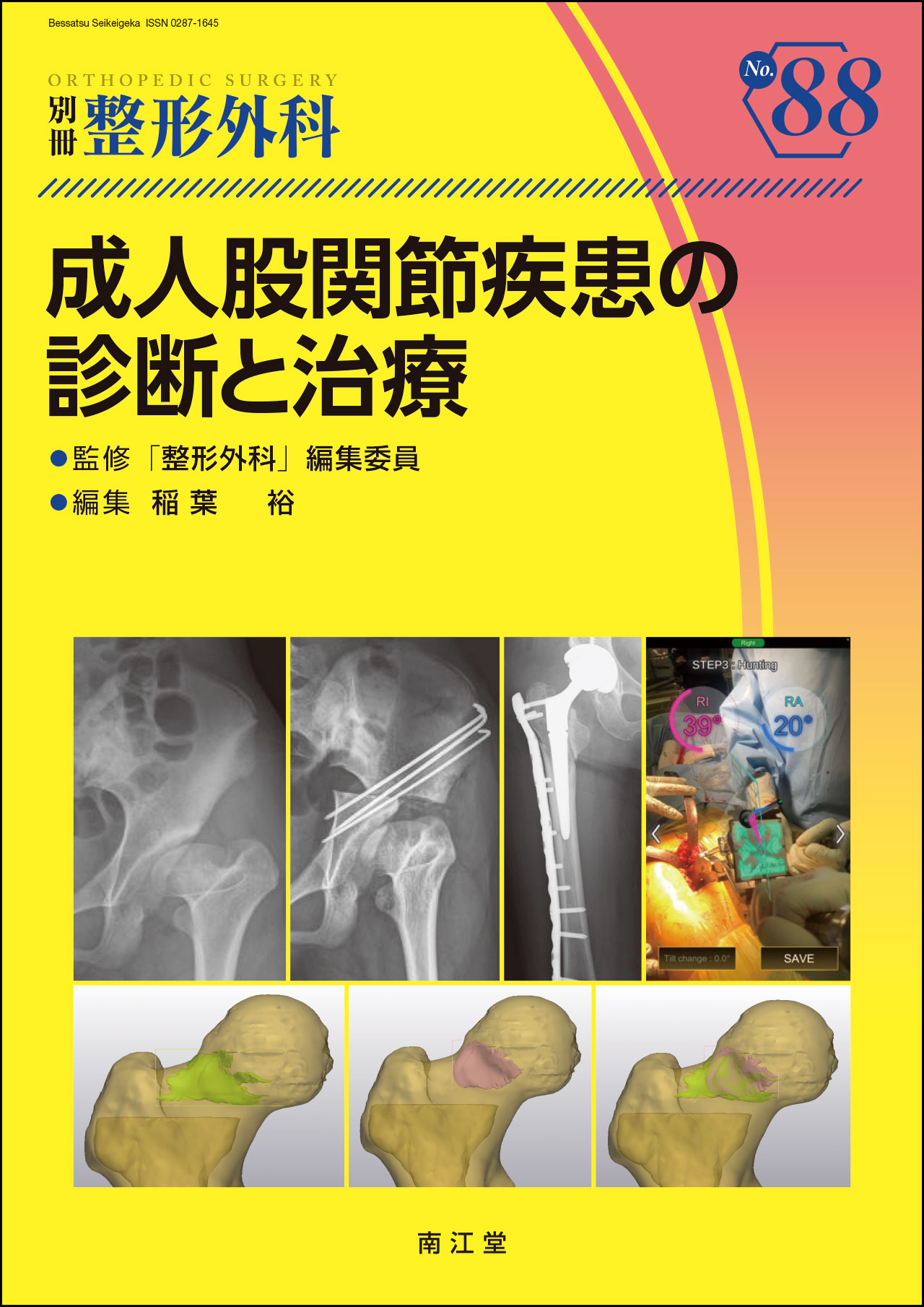 楽天市場】南江堂 成人股関節疾患の診断と治療/南江堂/稲葉裕（整形
