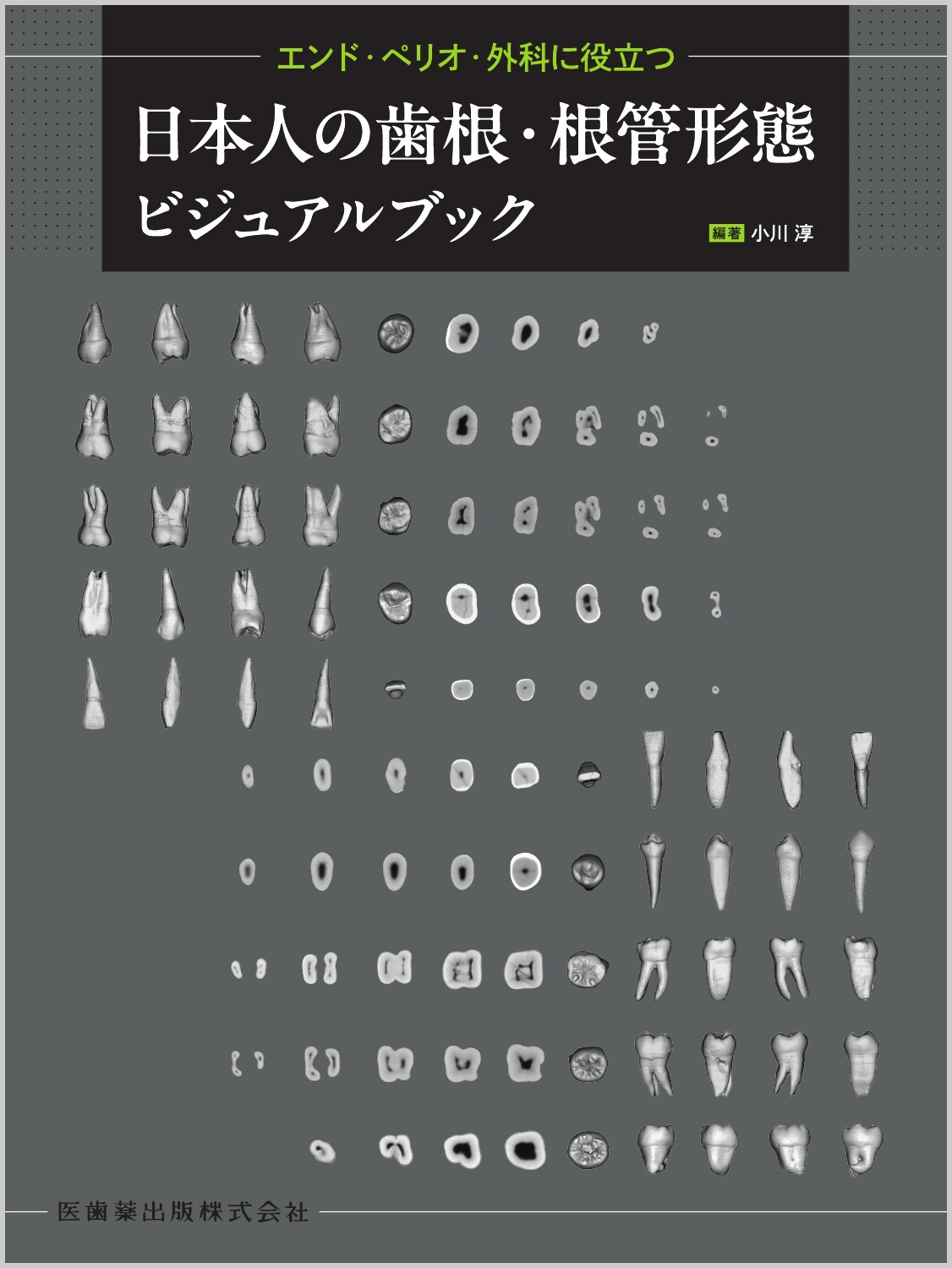 楽天市場】クインテッセンス出版 顎矯正手術エッセンシャル ビジュアル