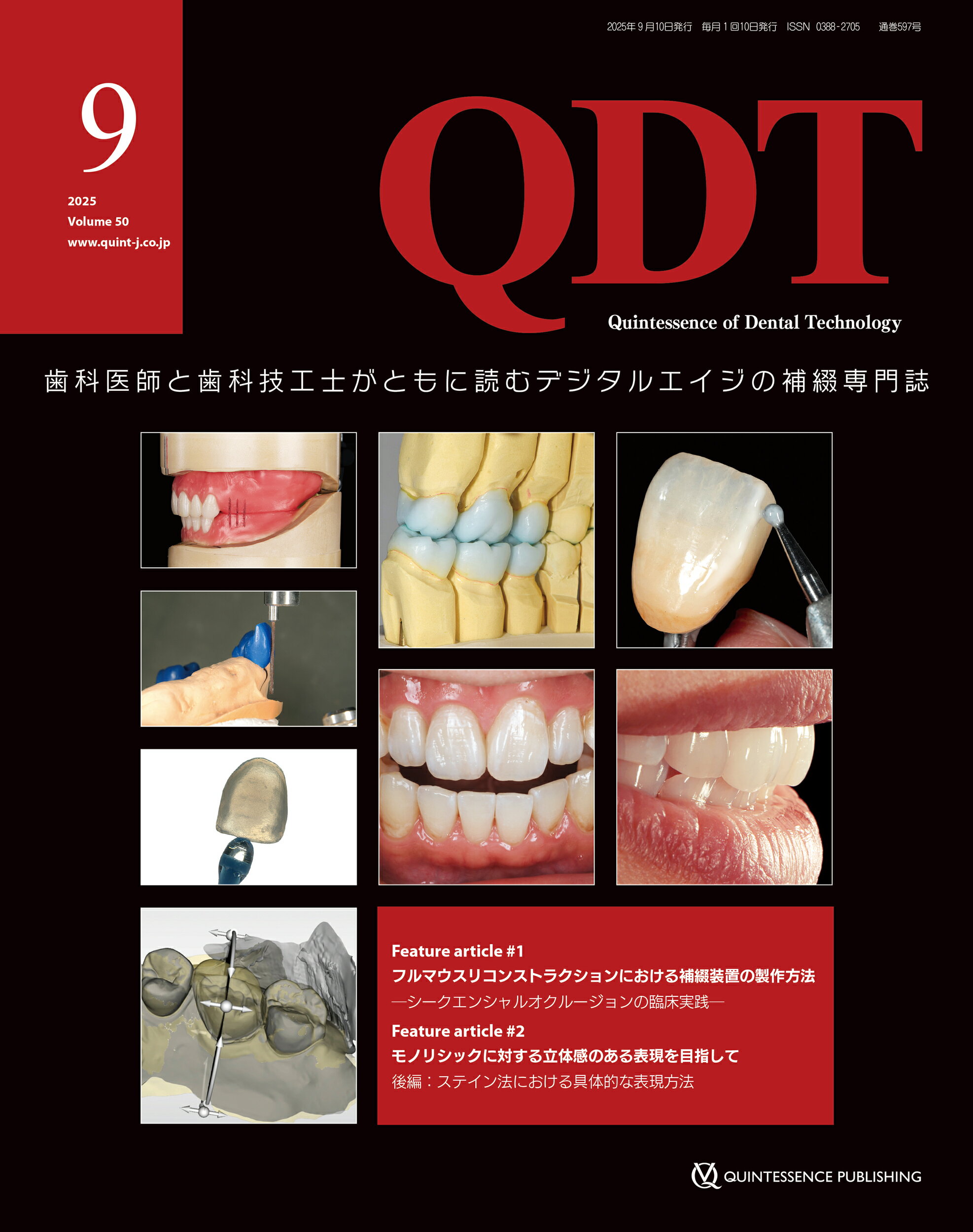 ＱＤＴ 歯科医師と歯科技工士がともに読むデジタルエイジの補 ２０２５年９月号/クインテッセンス出版/クインテッセンス出版