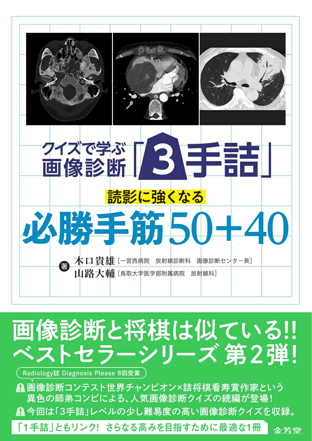 クイズで学ぶ画像診断「３手詰」　読影に強くなる必勝手筋５０＋４０/金芳堂/木口貴雄
