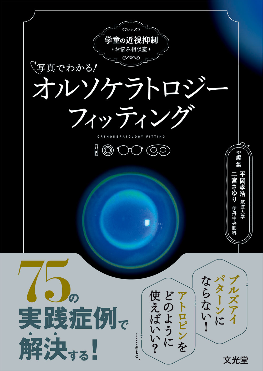 写真でわかる！オルソケラトロジーフィッティング 学童の近視抑制　お悩み相談室/文光堂/平岡孝浩