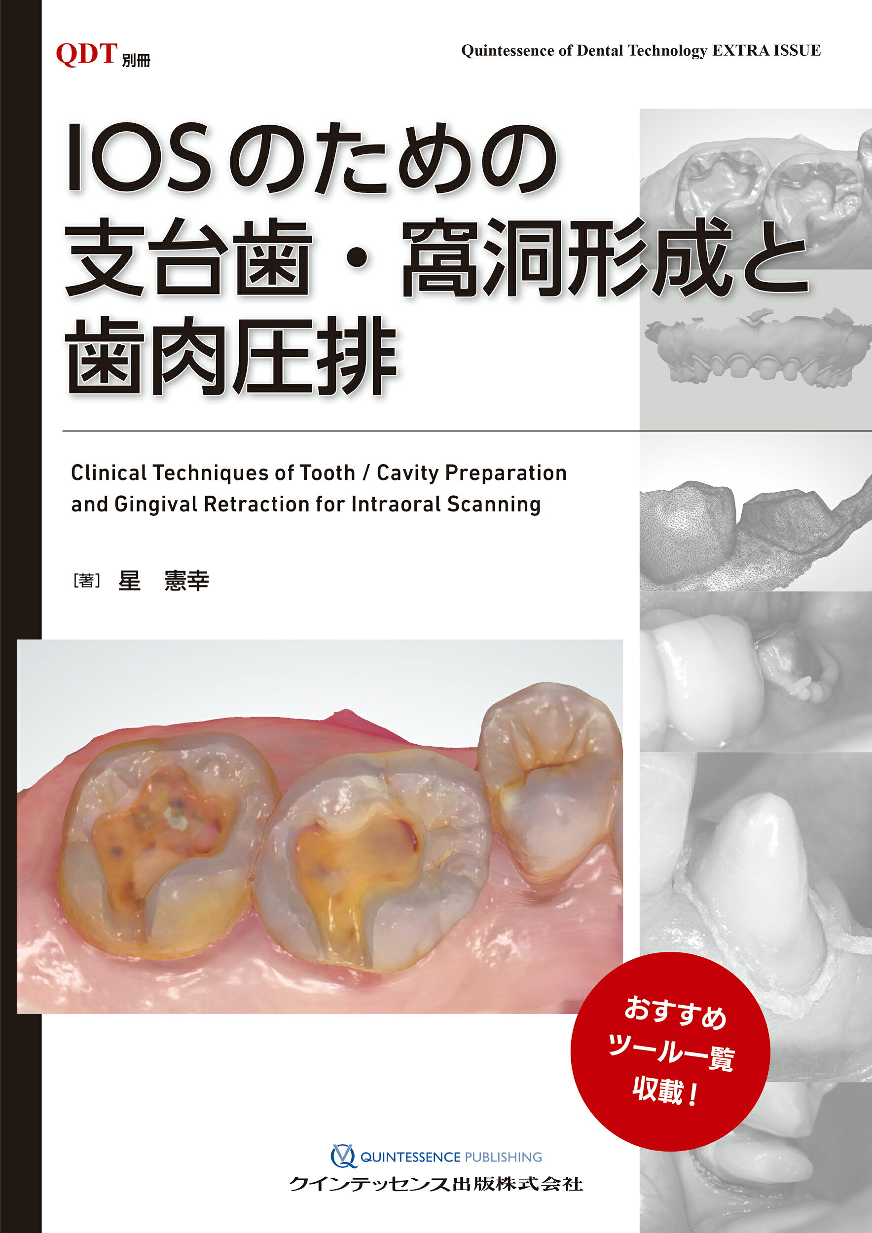 楽天市場】クインテッセンス出版 基礎から学ぶデジタル時代の矯正入門