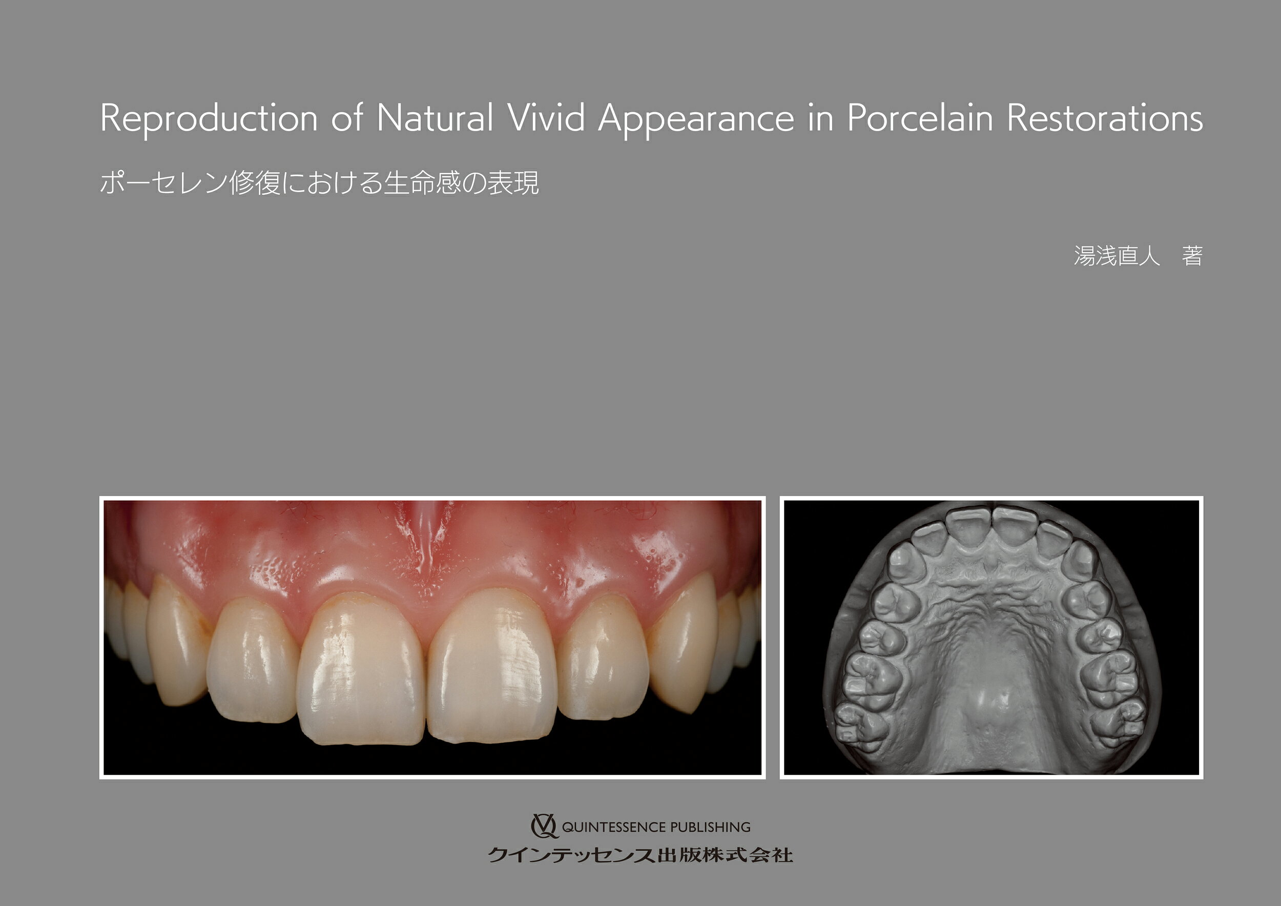 楽天市場】クインテッセンス出版 顎矯正手術エッセンシャル ビジュアル
