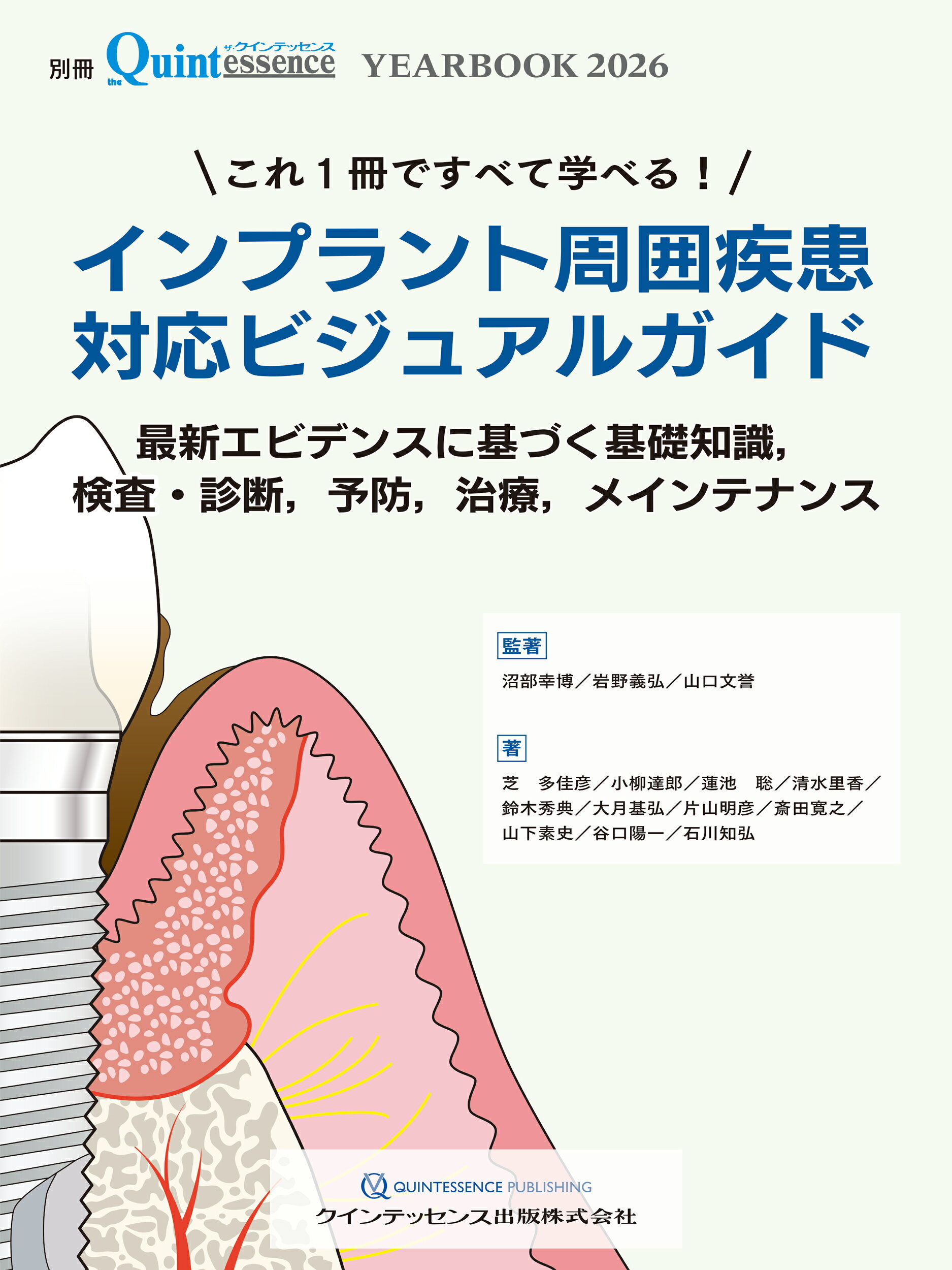 楽天市場】クインテッセンス出版 インプラント図鑑 視覚で巡る