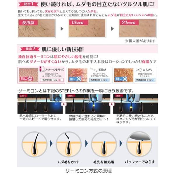 楽天市場】ヤーマン YA-MAN 脱毛器 STA-160R | 価格比較 - 商品価格ナビ