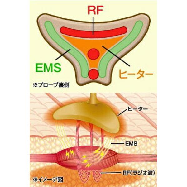 ほうれい線アイロン ナソラヴィアルフォールドES シャンパンゴールド YMO-… 楽天市場】オムニ ほうれい線アイロン ナソラヴィアルフォールド