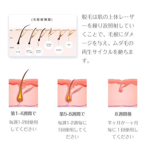 楽天市場】BURRKI IPL脱毛器 MY-992A | 価格比較 - 商品価格ナビ