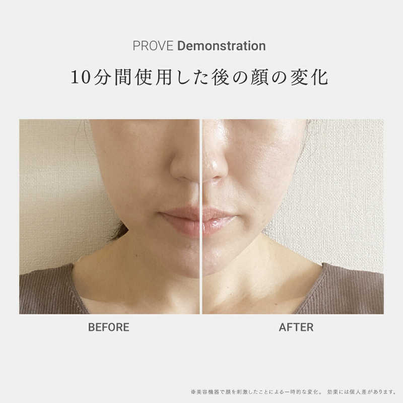 MYTREX PROVE トータルリフト美顔器 創通メディカル 日本公式