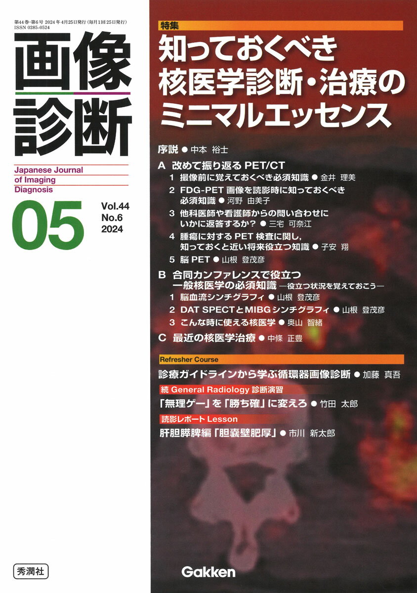 画像診断 ２０２４年５月号Ｖｏｌ．４４Ｎ/Ｇａｋｋｅｎ