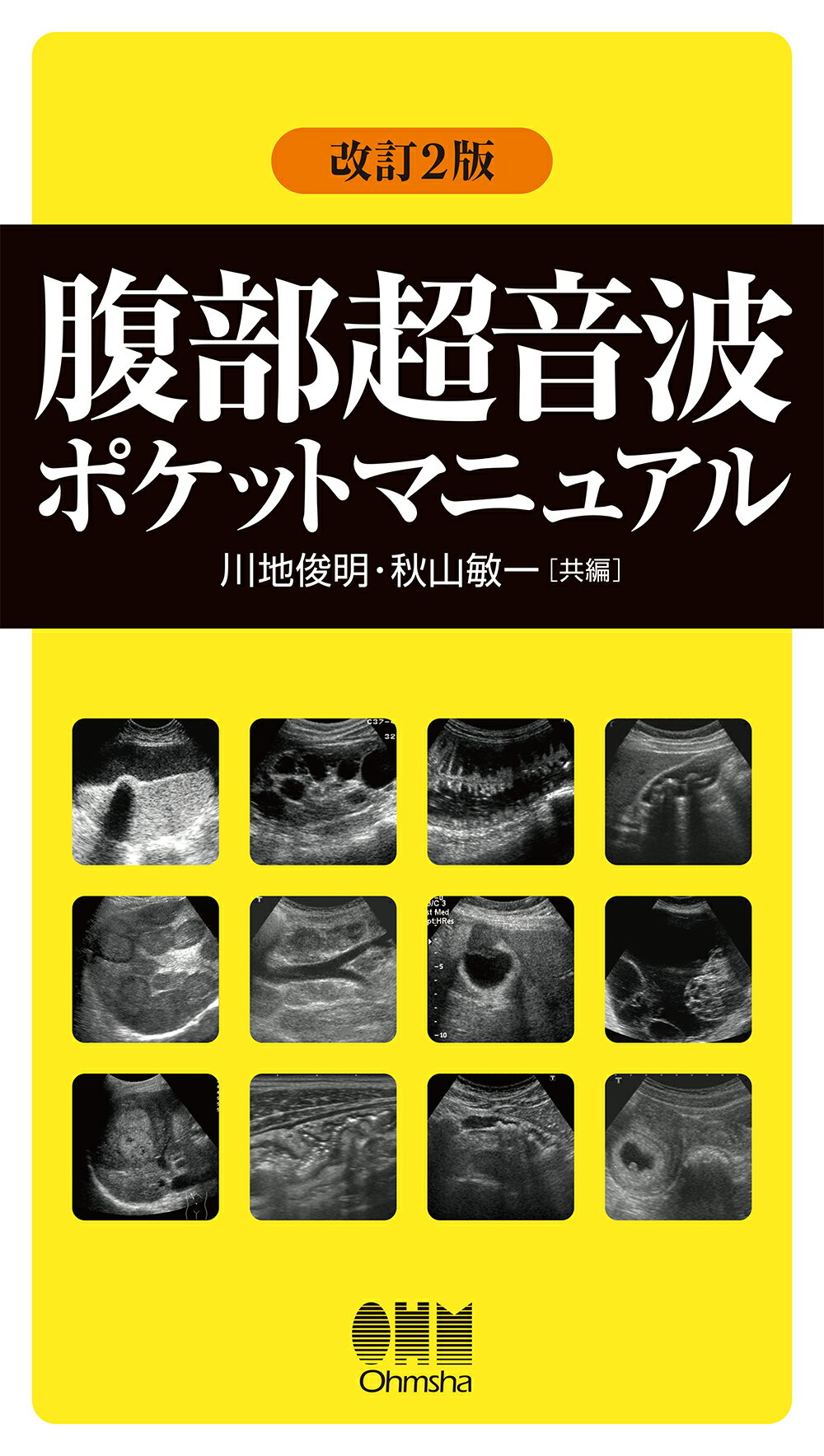 腹部超音波テキスト〜上・下腹部〜 改訂第三版 (Atlas Series超音波編 ...