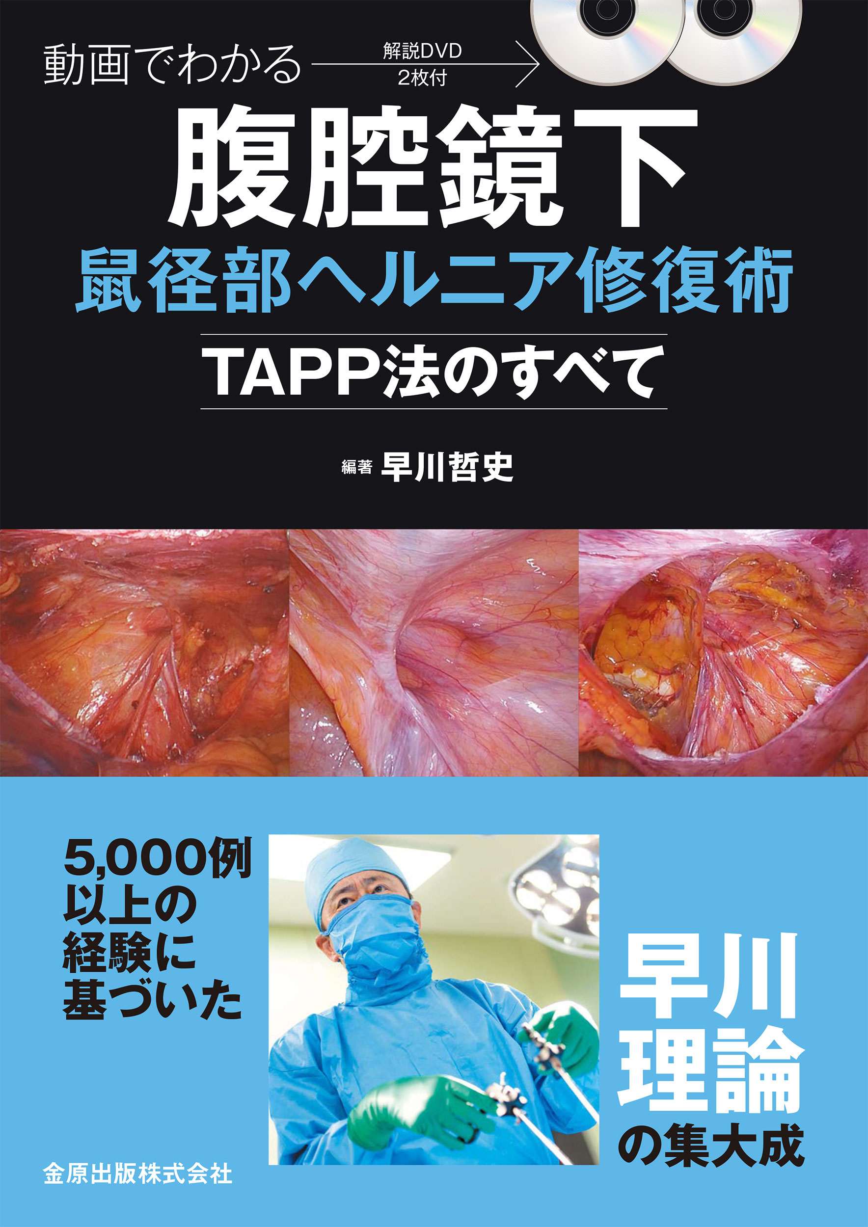 動画でわかる腹腔鏡下胆嚢摘出術
