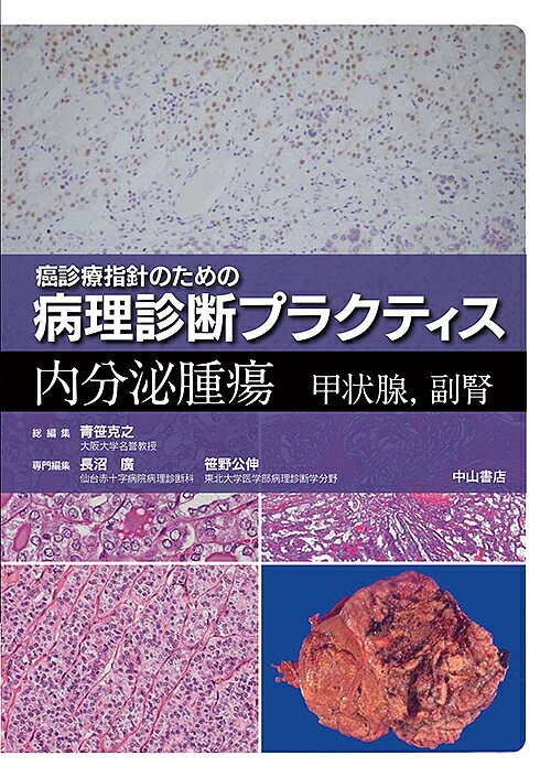 楽天市場 中山書店 癌診療指針のための病理診断プラクティス 内分泌腫瘍 甲状腺 副腎 中山書店 青笹克之 価格比較 商品価格ナビ