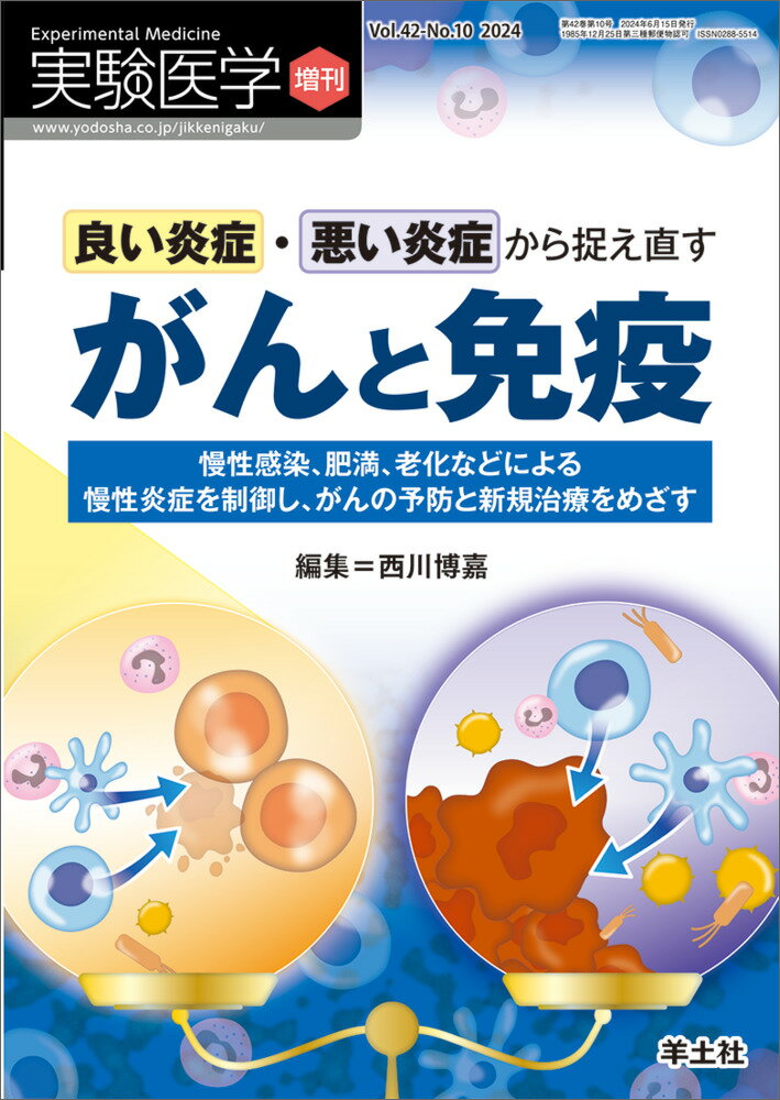 良い炎症・悪い炎症から捉え直すがんと免疫/羊土社/西川博嘉