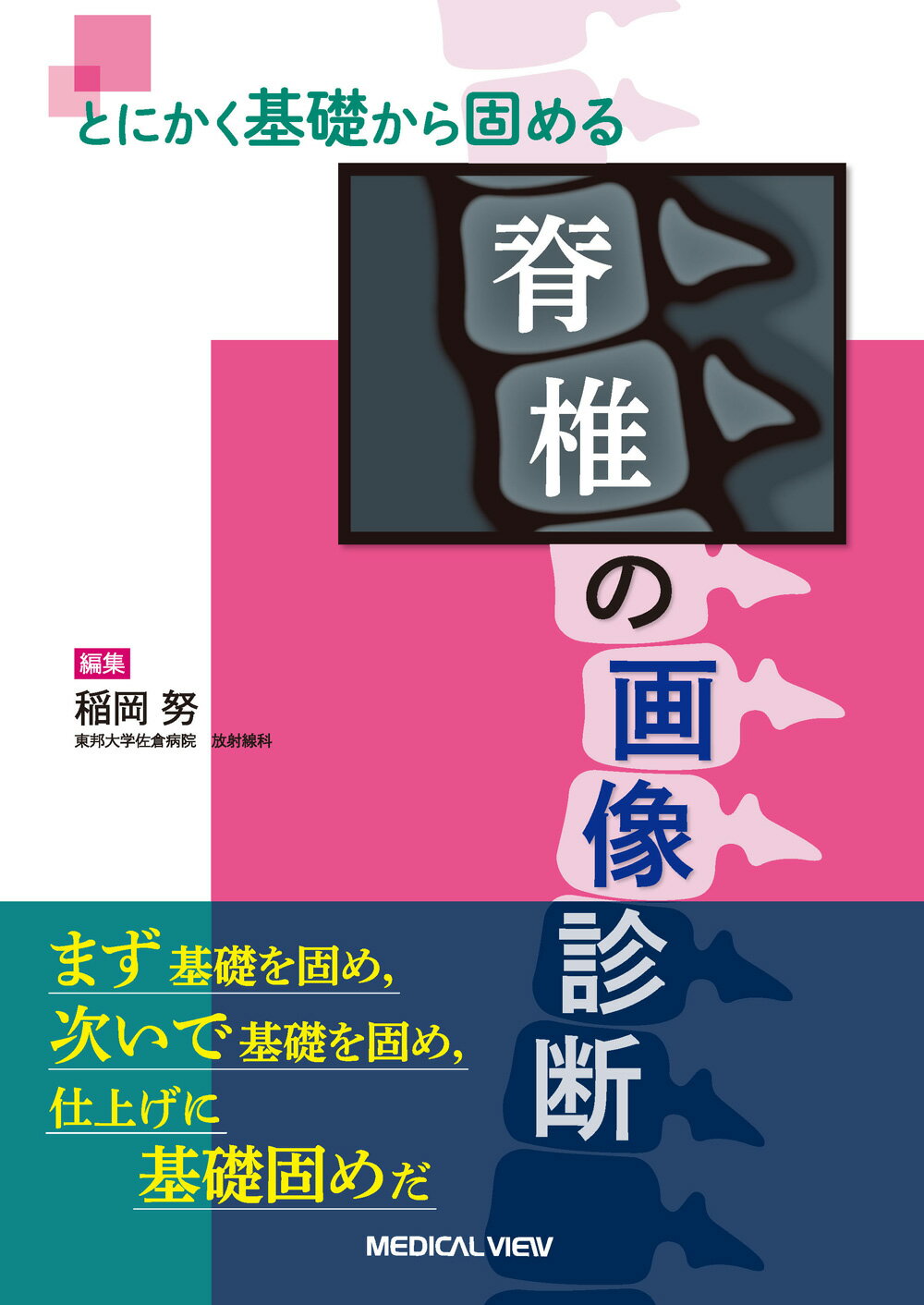 骨折の画像診断 : 救急・当直で必ず役立つ! : 全身の骨折分類の