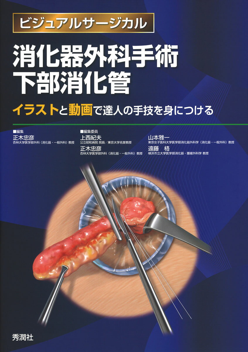 楽天市場】学研マーケティング 消化器外科手術胆道・膵臓 標準手技の