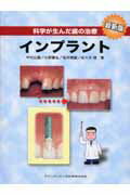 楽天市場】クインテッセンス出版 現代の臨床補綴 歯周治療をふまえた 