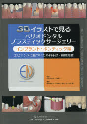楽天市場 クインテッセンス出版 ３ｄイラストで見るペリオドンタルプラスティックサージェリー インプラント ポンテ エビデンスに基づいた外科手技 補綴処置 クインテッセンス出版 中田光太郎 価格比較 商品価格ナビ