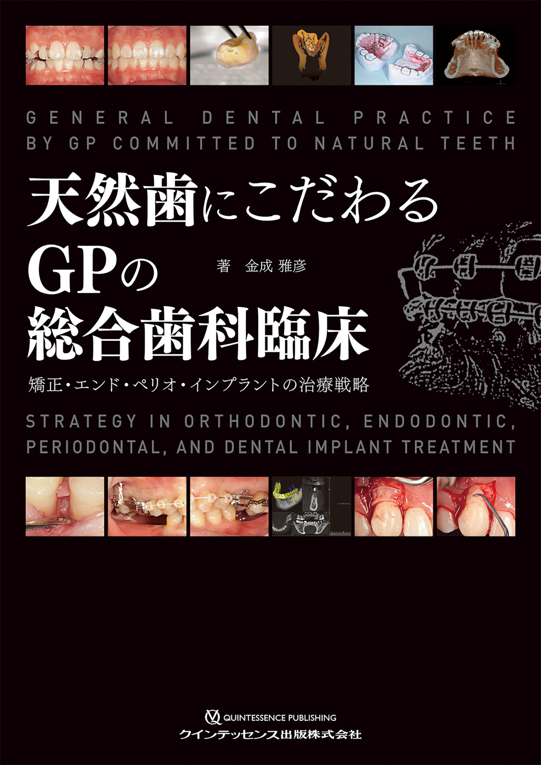 楽天市場】クインテッセンス出版 矯正歯科治療ガイドブック 一般歯科の 