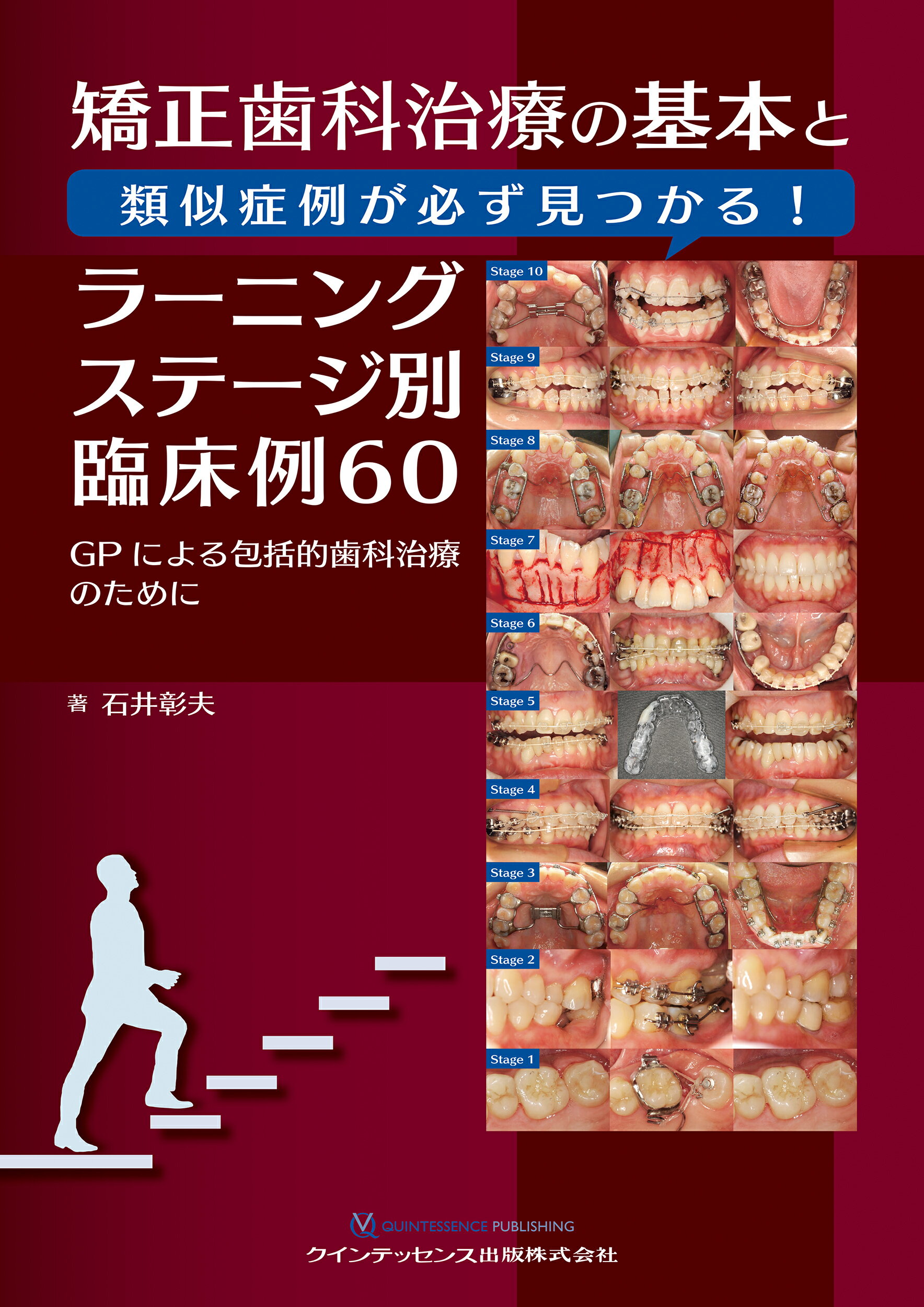 72％以上節約 包括臨床に活かすMTM : やさしい症例から始められる