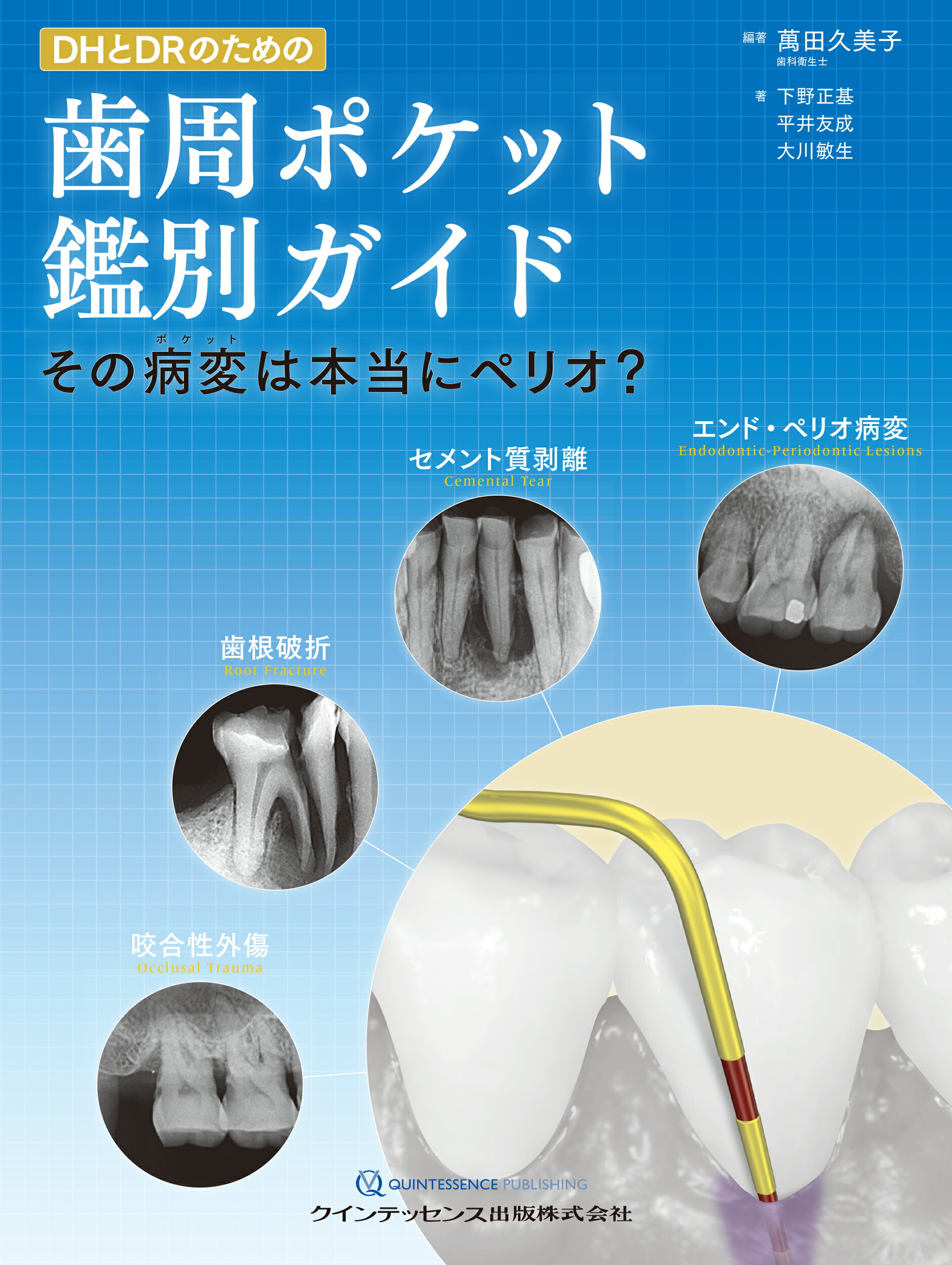 基礎と臨床がつながる歯周解剖の+inforsante.fr