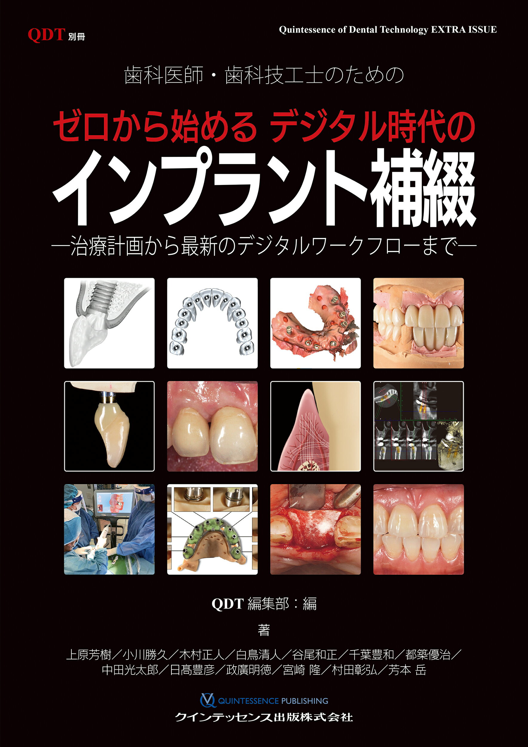若手歯科医師・技工士のためのインプラント補綴・技工超入門